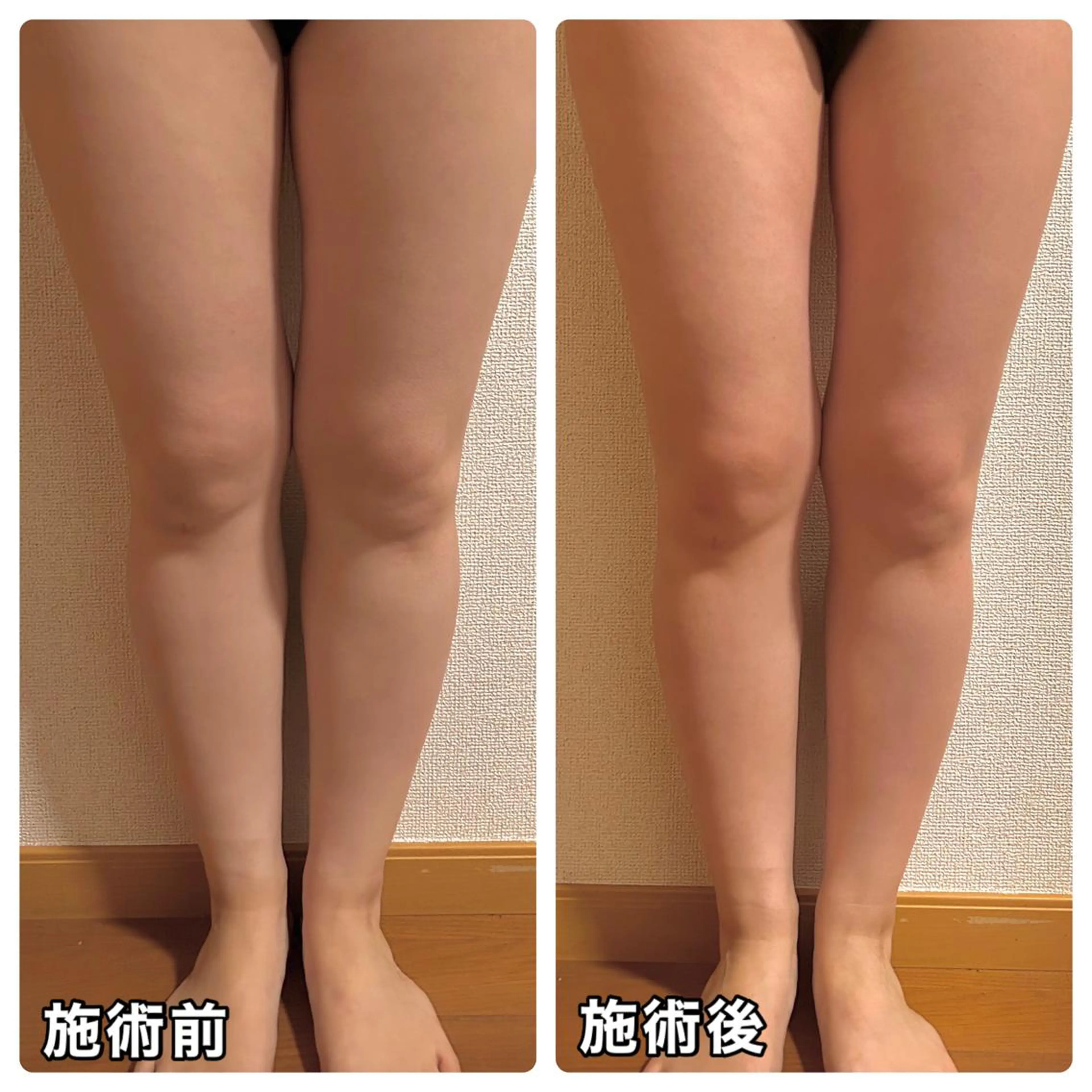 🌴Beauty Salon LANAのエステ・リラクイメージ