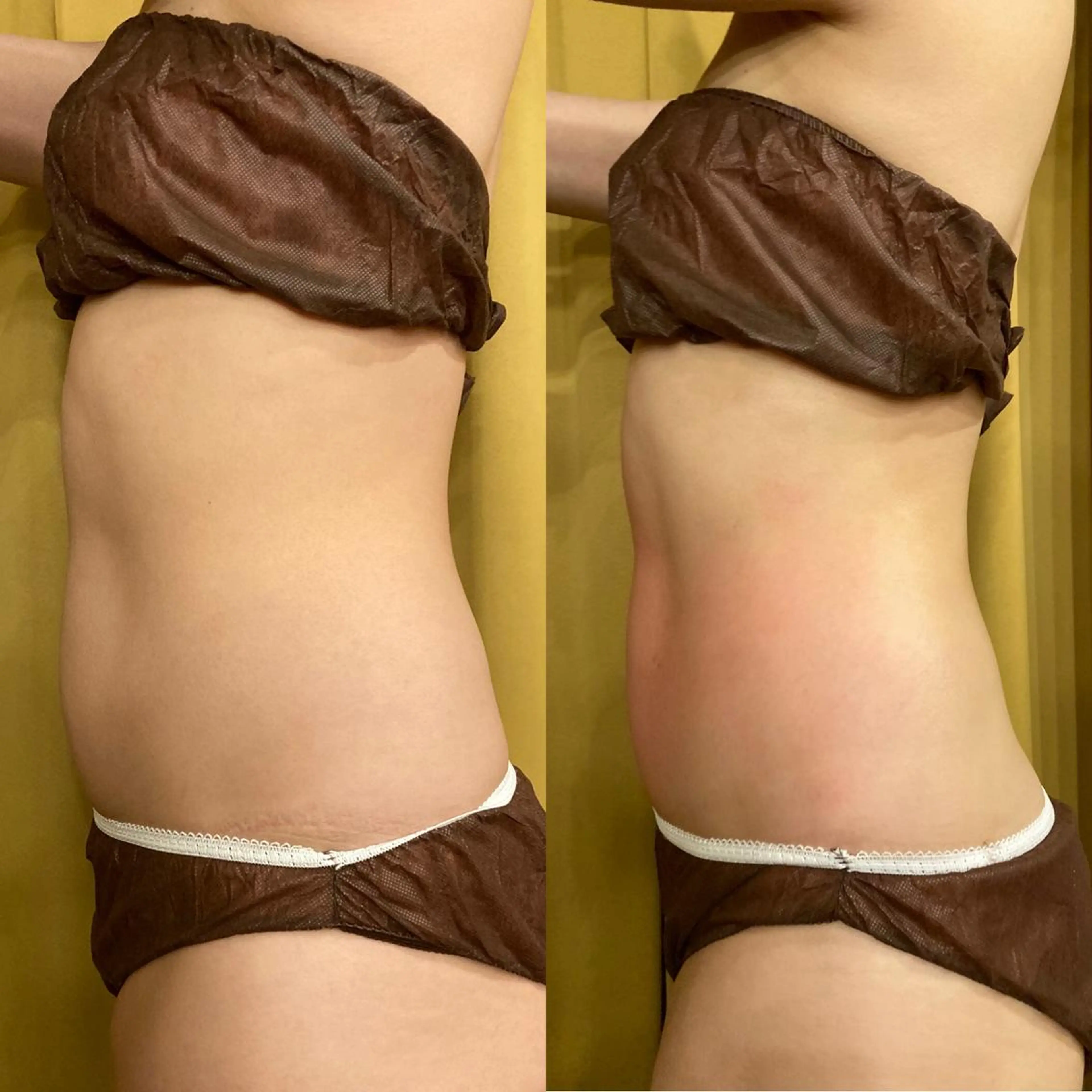 その他 小顔やたるみに特化 💚野瀬可蓮のその他イメージ