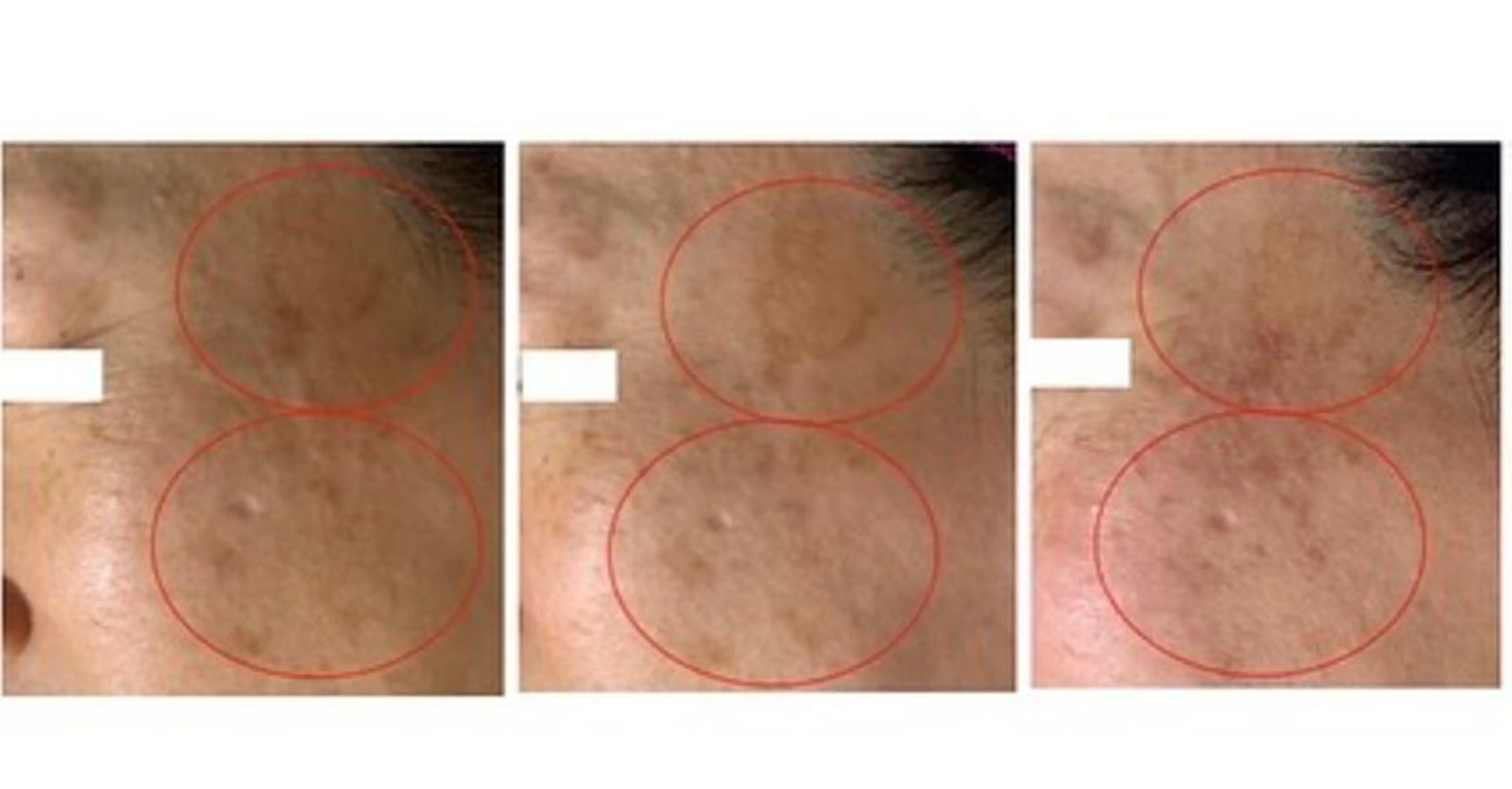 エステ ヴィーナス ビューティーのエステ・リラクイメージ