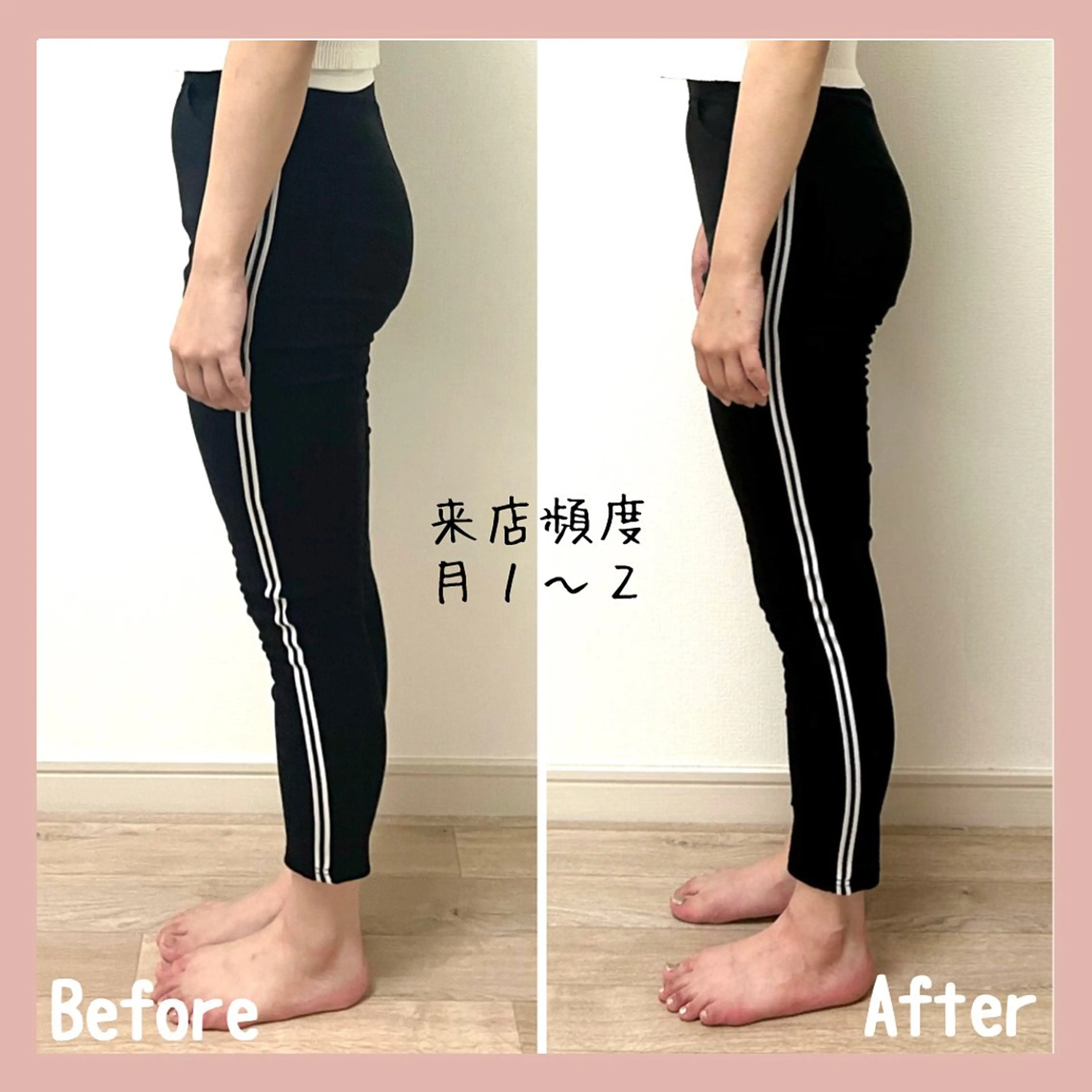 小顔モニター 募集のエステ・リラクイメージ