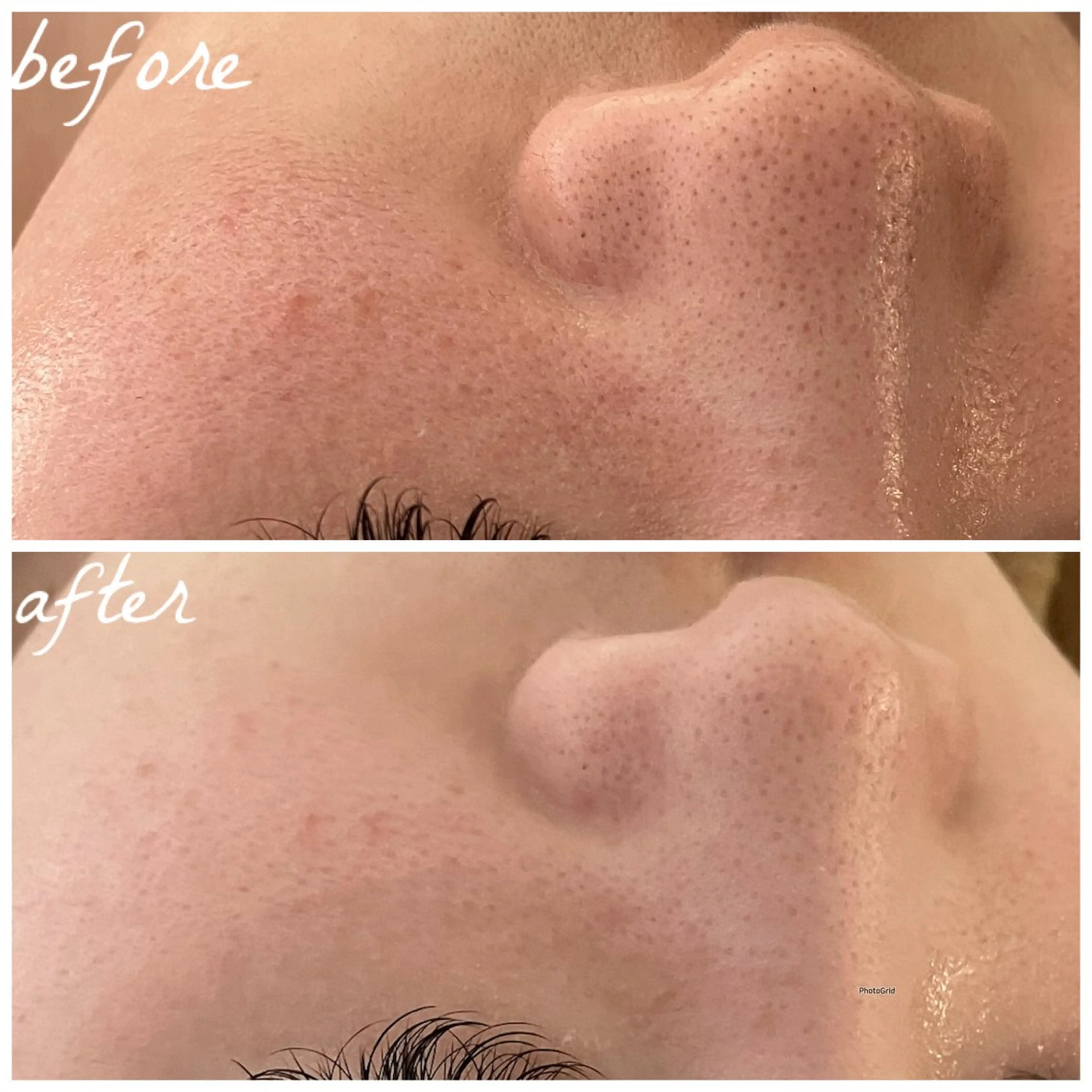 メンズ エステ メナード岐阜市茜部 杉浦のエステ・リラクイメージ