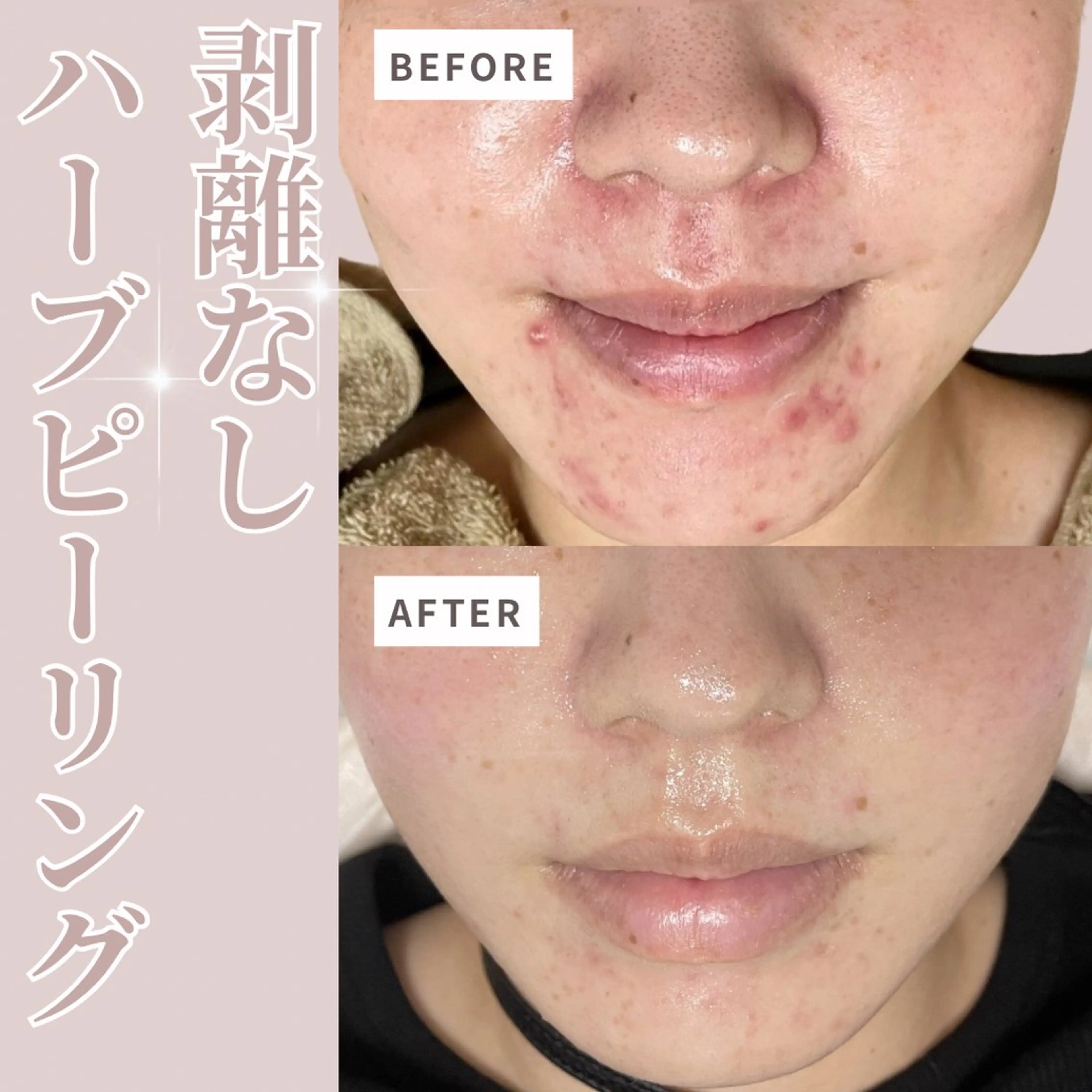 エステ リラク プライベートサロン Belle（ベル）のエステ・リラクイメージ