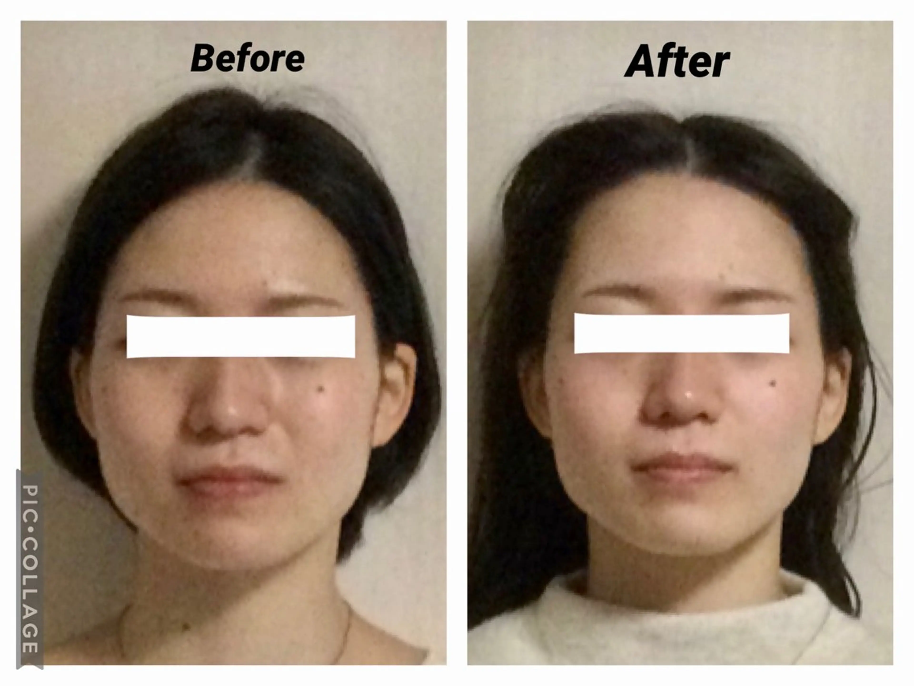 エステ リラク 小顔矯正Sho  FaceDesignのエステ・リラクイメージ