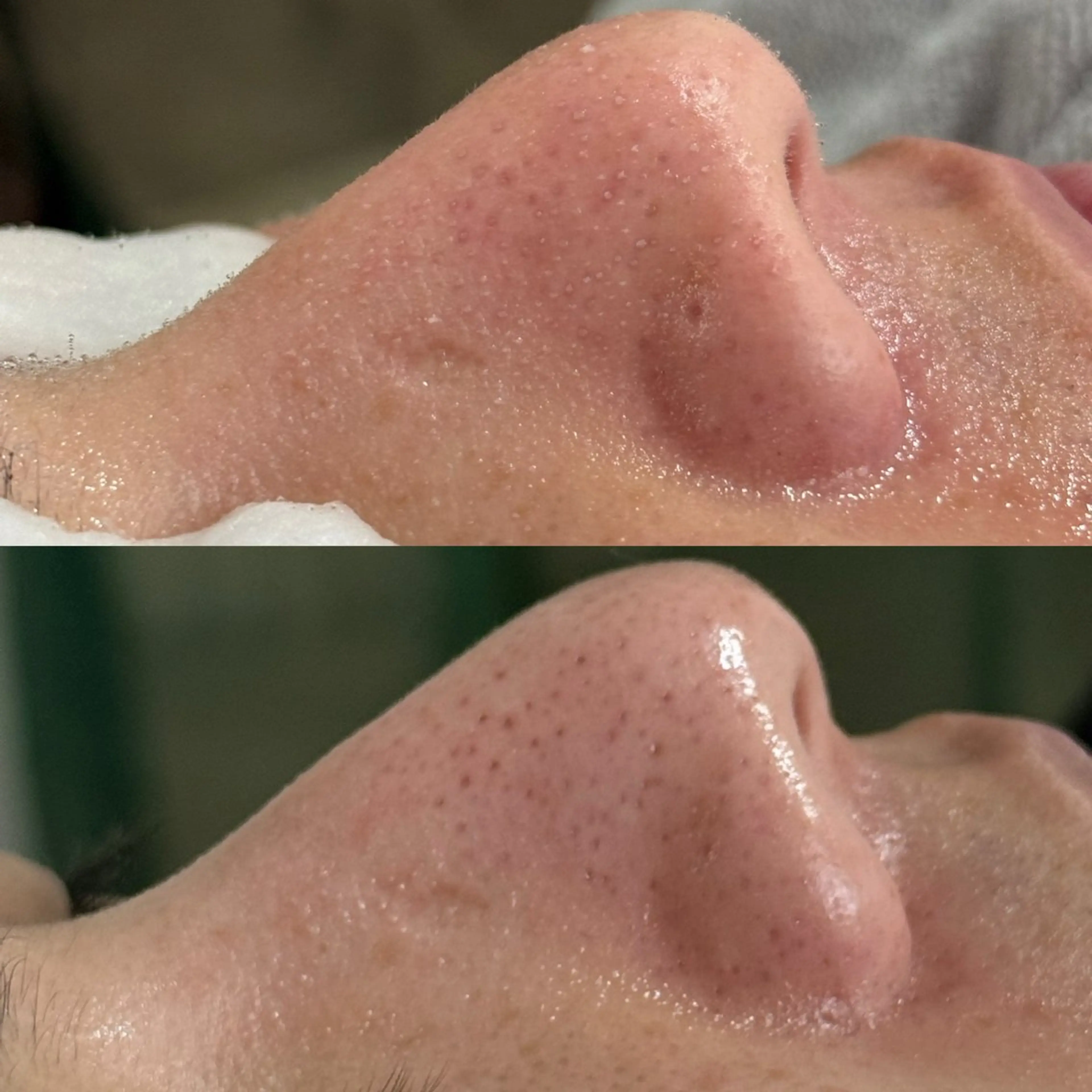 Rairy所属・Rairy Salon富士見町のエステ・リラクイメージ