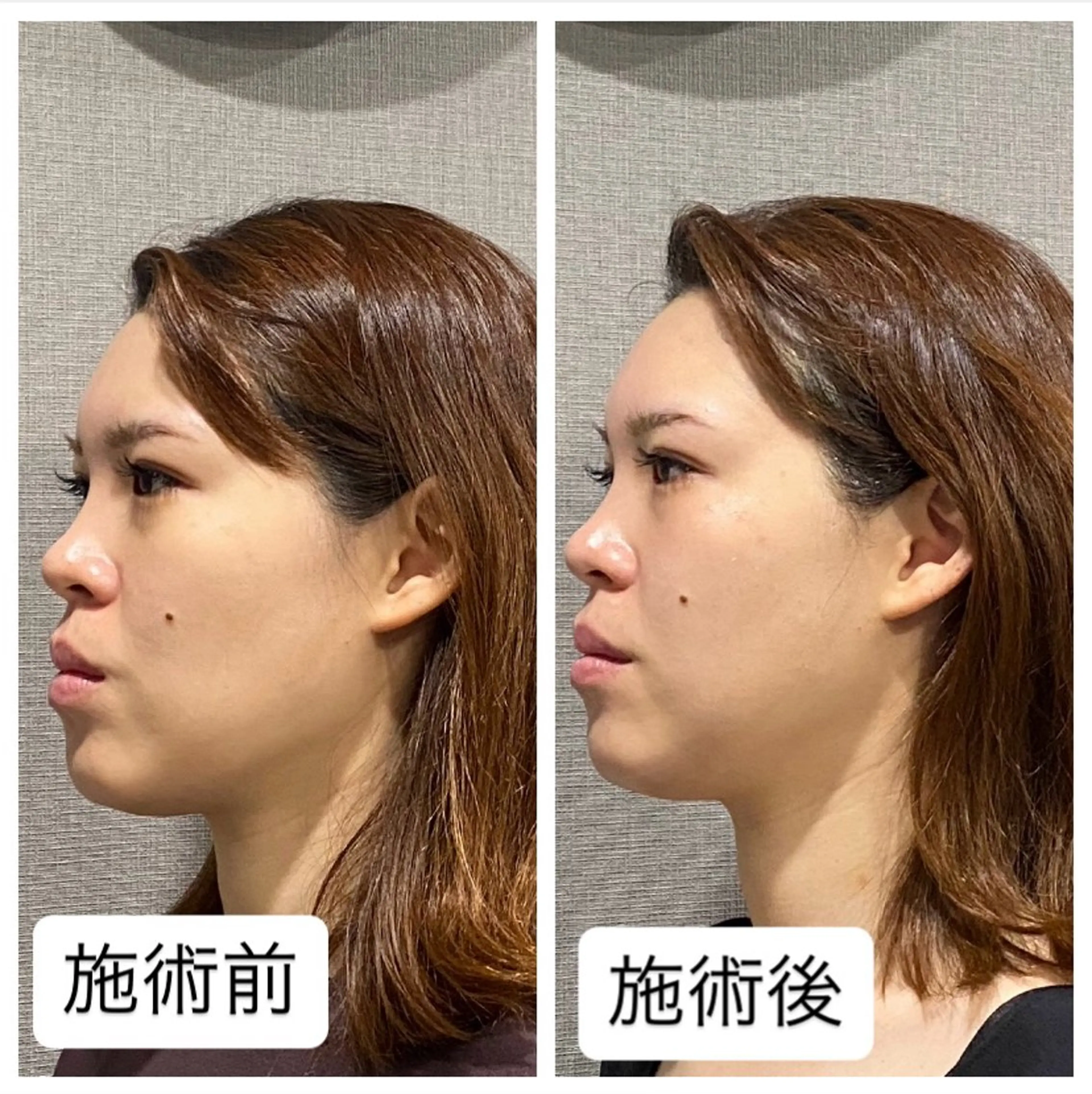 エステ 肌質改善専門 ハーブ /毛穴洗浄 リエイトのエステ・リラクイメージ