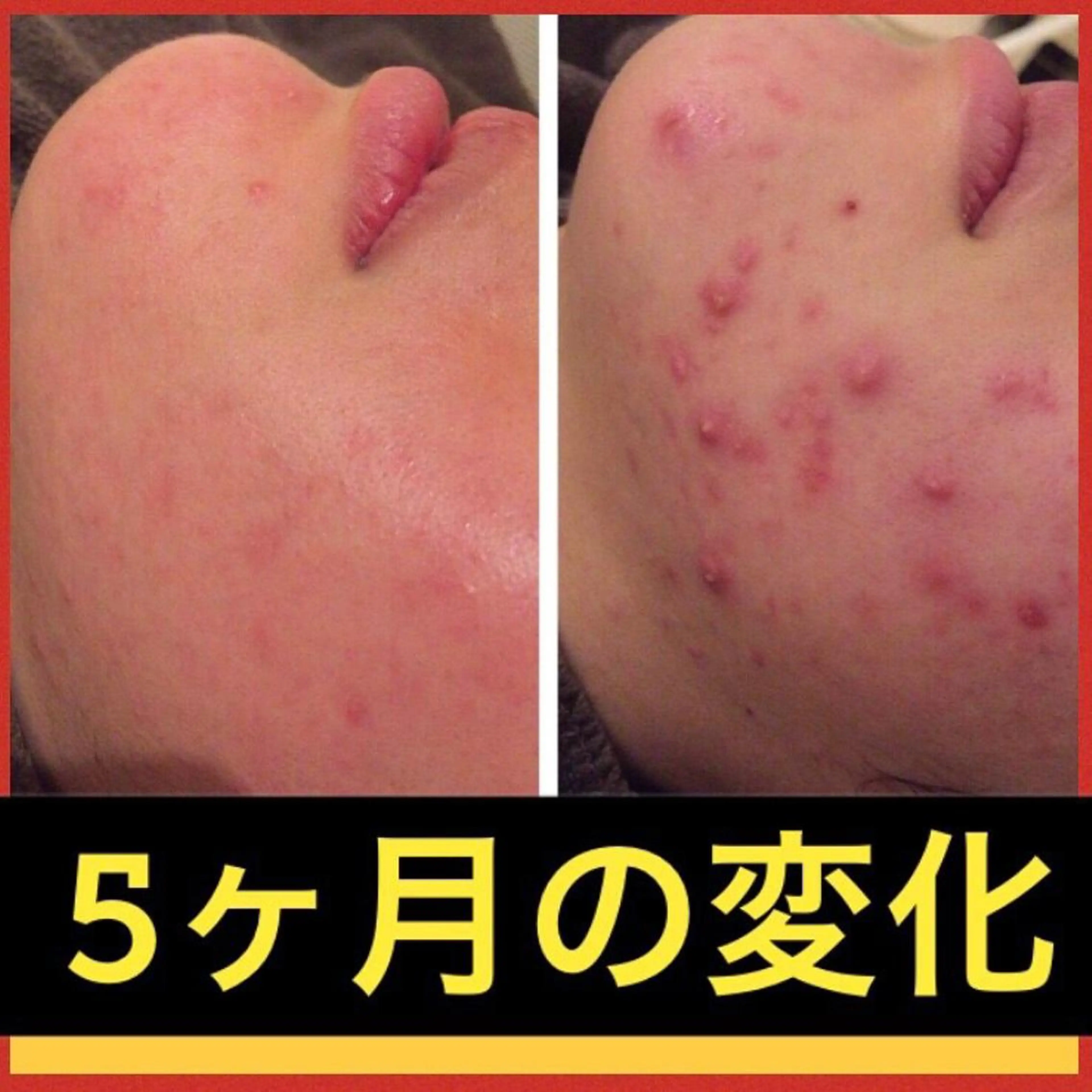 ミディアム カラー パーマ ヘアアレンジ メンズ キッズ ネイル マツエク・マツパ ニキビ・肌質改善専門 ♡人生が変わるサロンのエステ・リラクイメージ