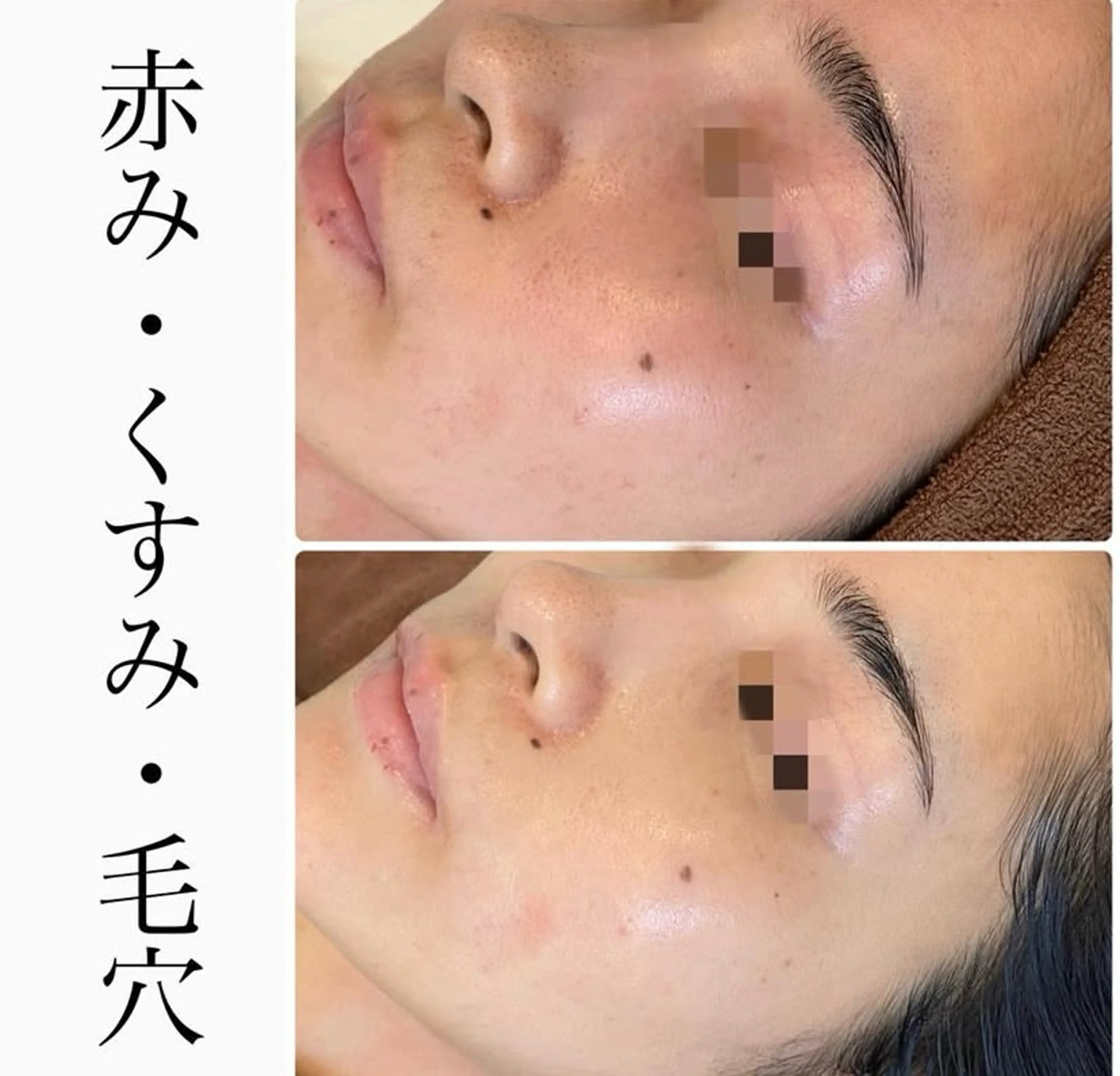 エステ ハーブピーリング専門 BIOPLUS+川崎のエステ・リラクイメージ