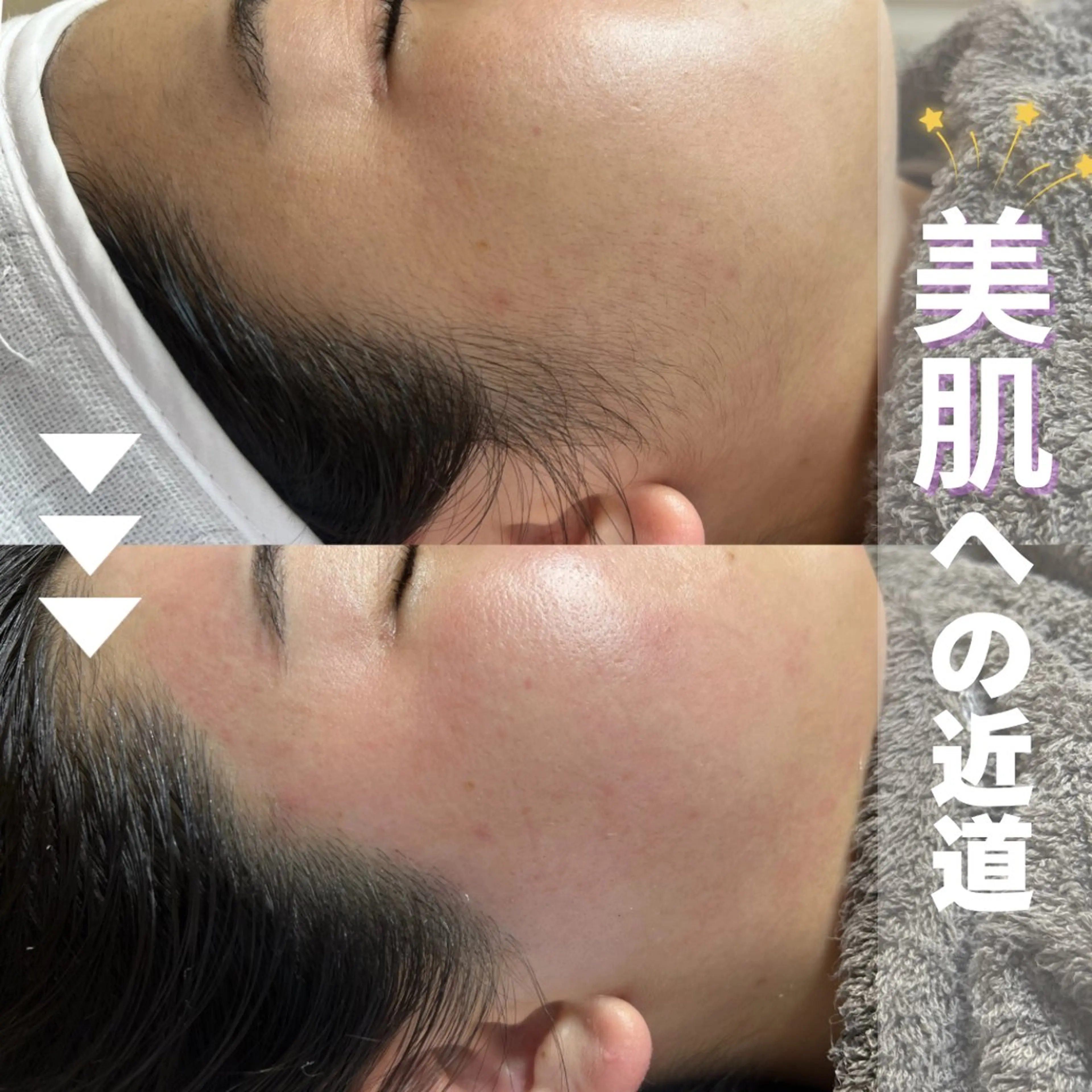 【学割🩵U24】フルフェイシャルワックス♪の写真