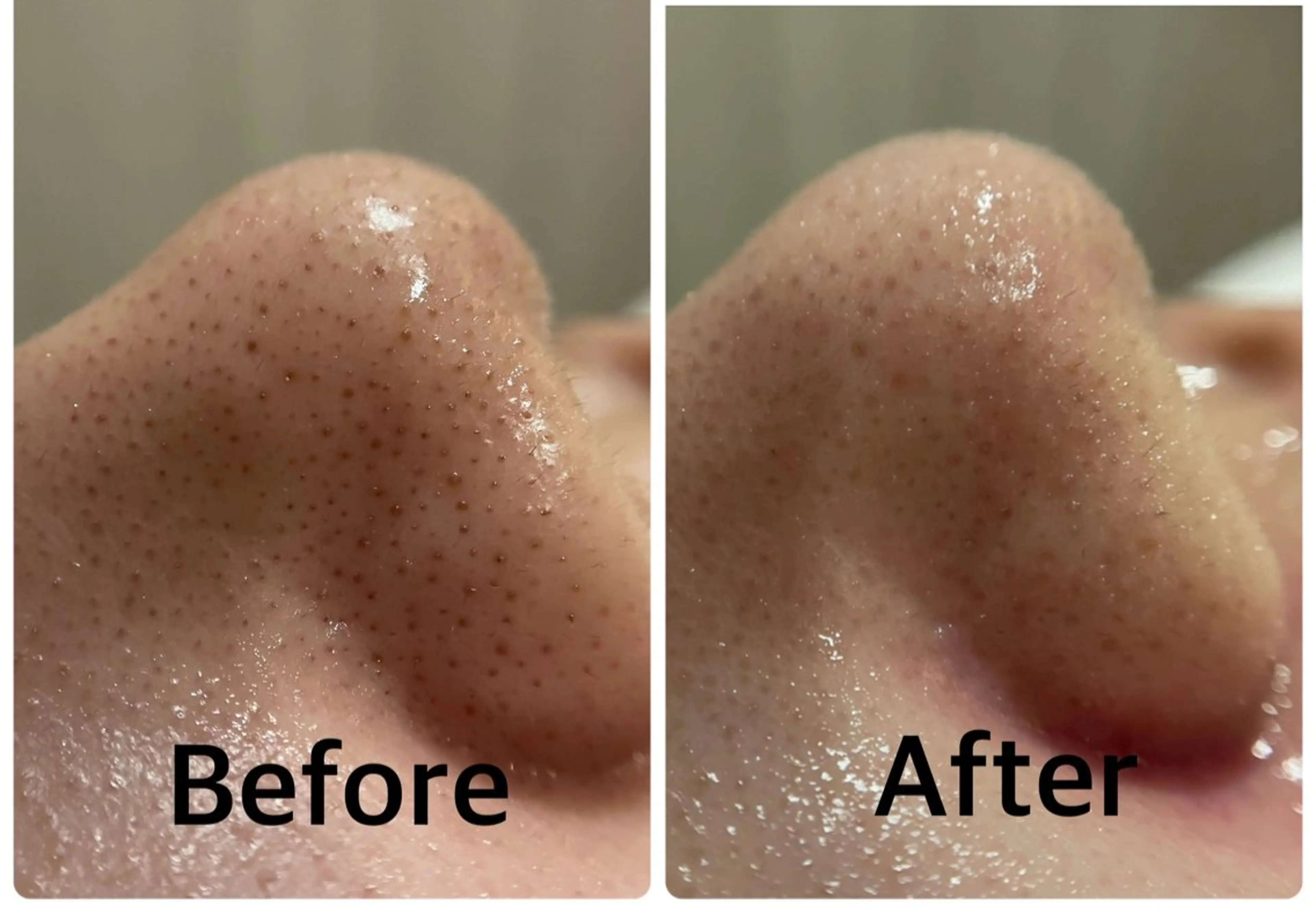 エステ 中山 彰大のその他イメージ