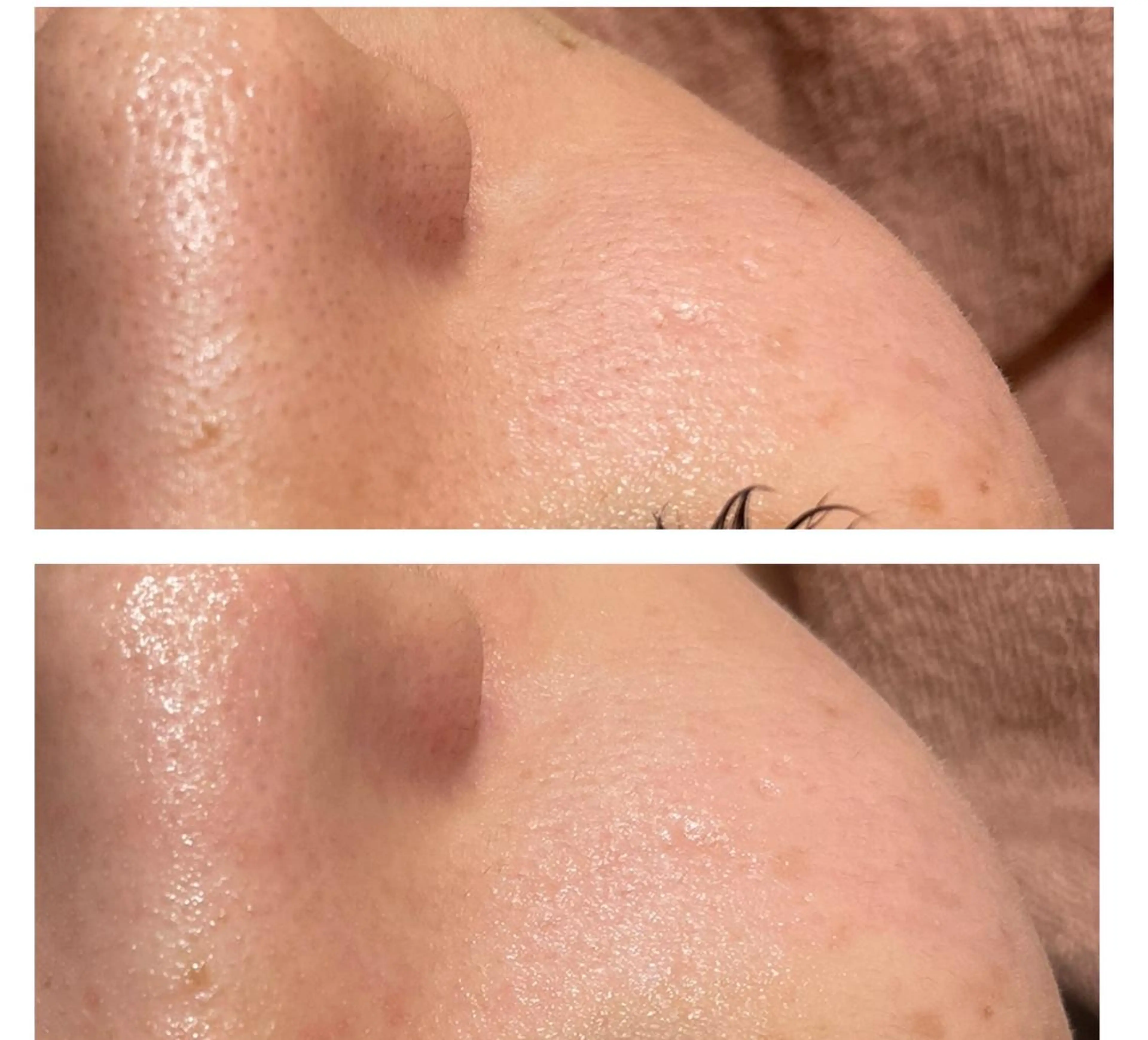 エステ リラク ♡美バスト美姿勢♡ 池袋TUKADA☆のエステ・リラクイメージ