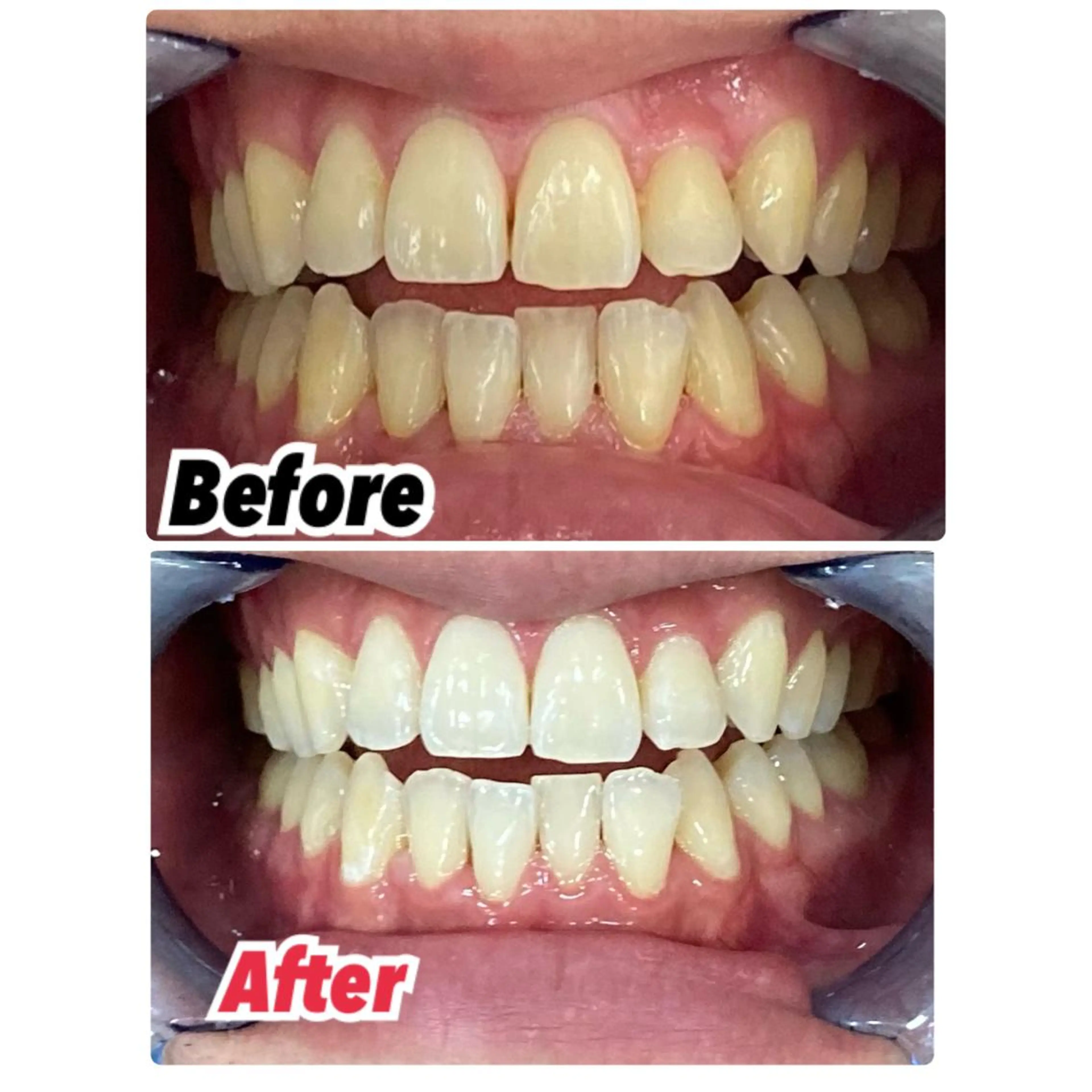 メンズ キッズ ネイル マツエク・マツパ アイブロウ 【歯科提携】柏ホワイ トニングスタイルのその他イメージ