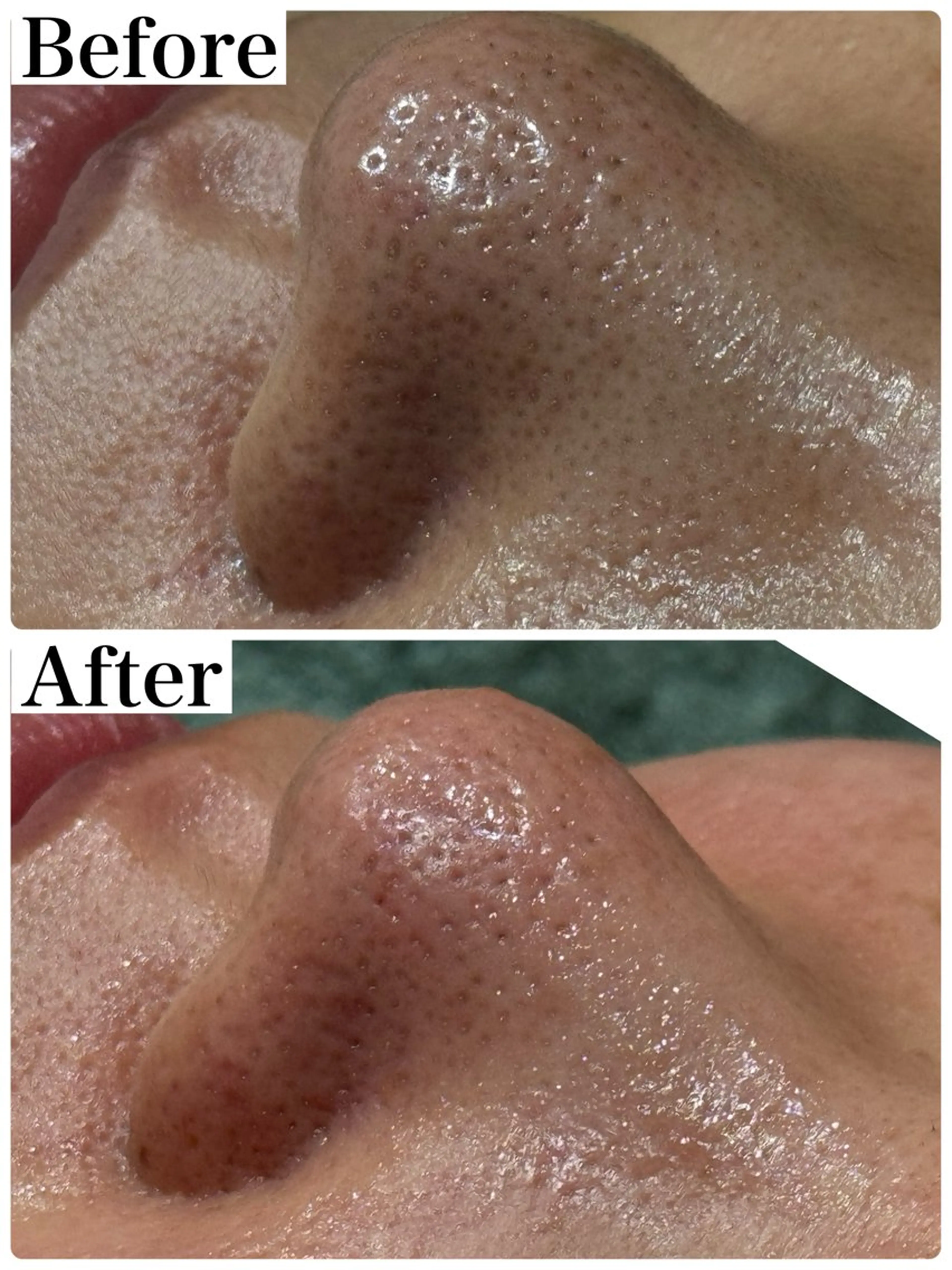 エステ 脱毛&フェイシャル 専門店muro.のエステ・リラクイメージ