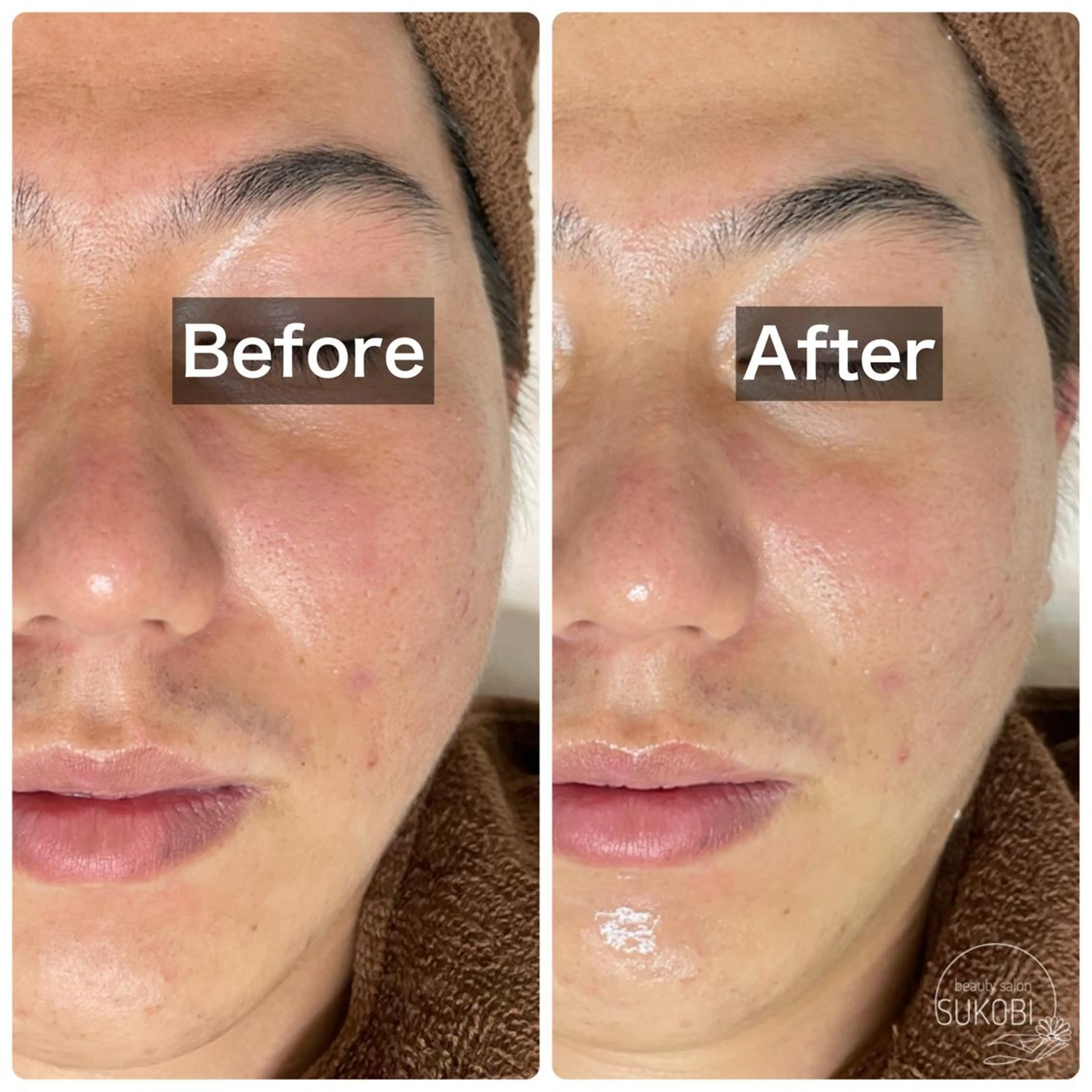 beauty salon  SUKOBI所属・ﾋﾞｭｰﾃｨｻﾛﾝ SUKOBIのエステ・リラクイメージ