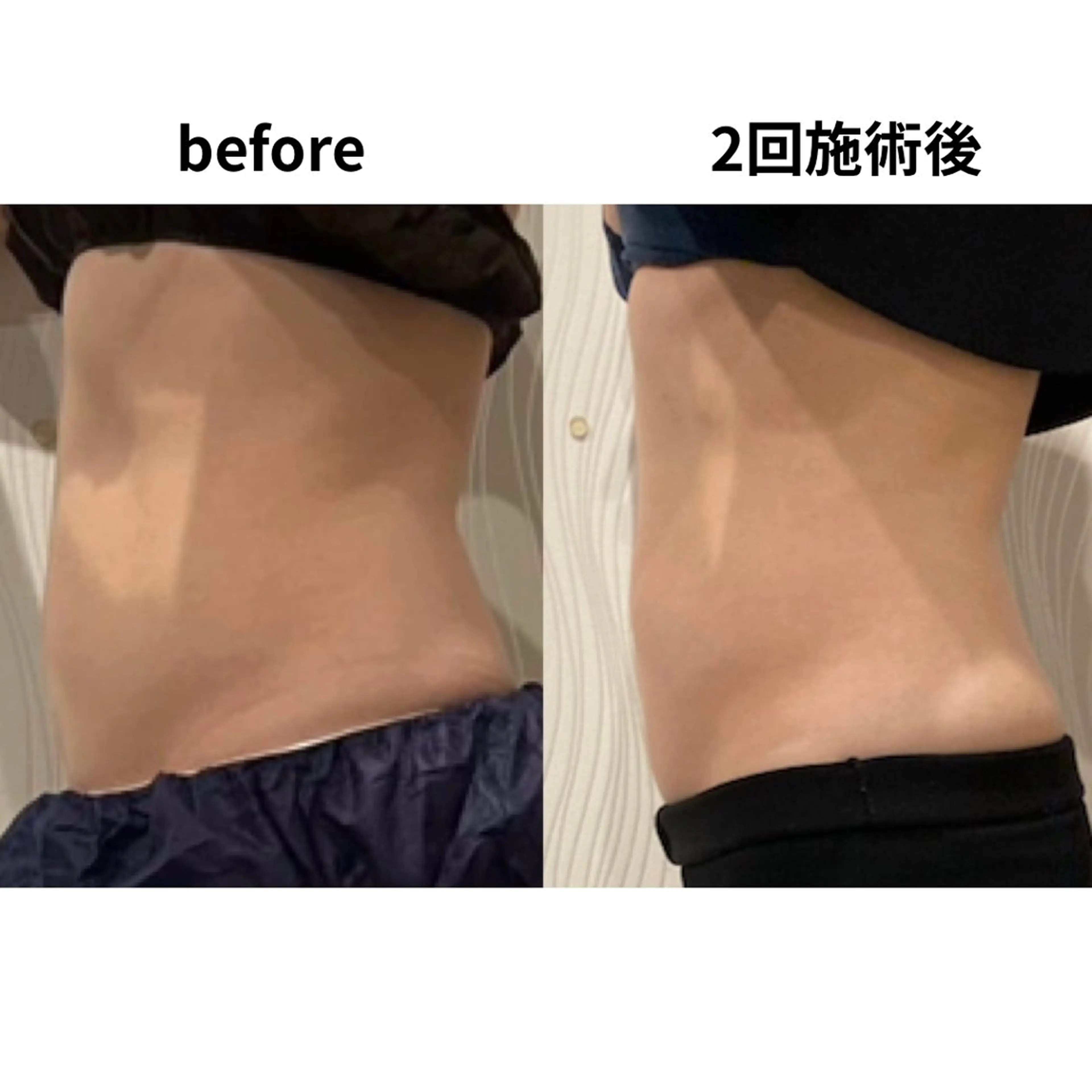 エステ Dahlia痩身脱毛 フェイシャル 中村のエステ・リラクイメージ