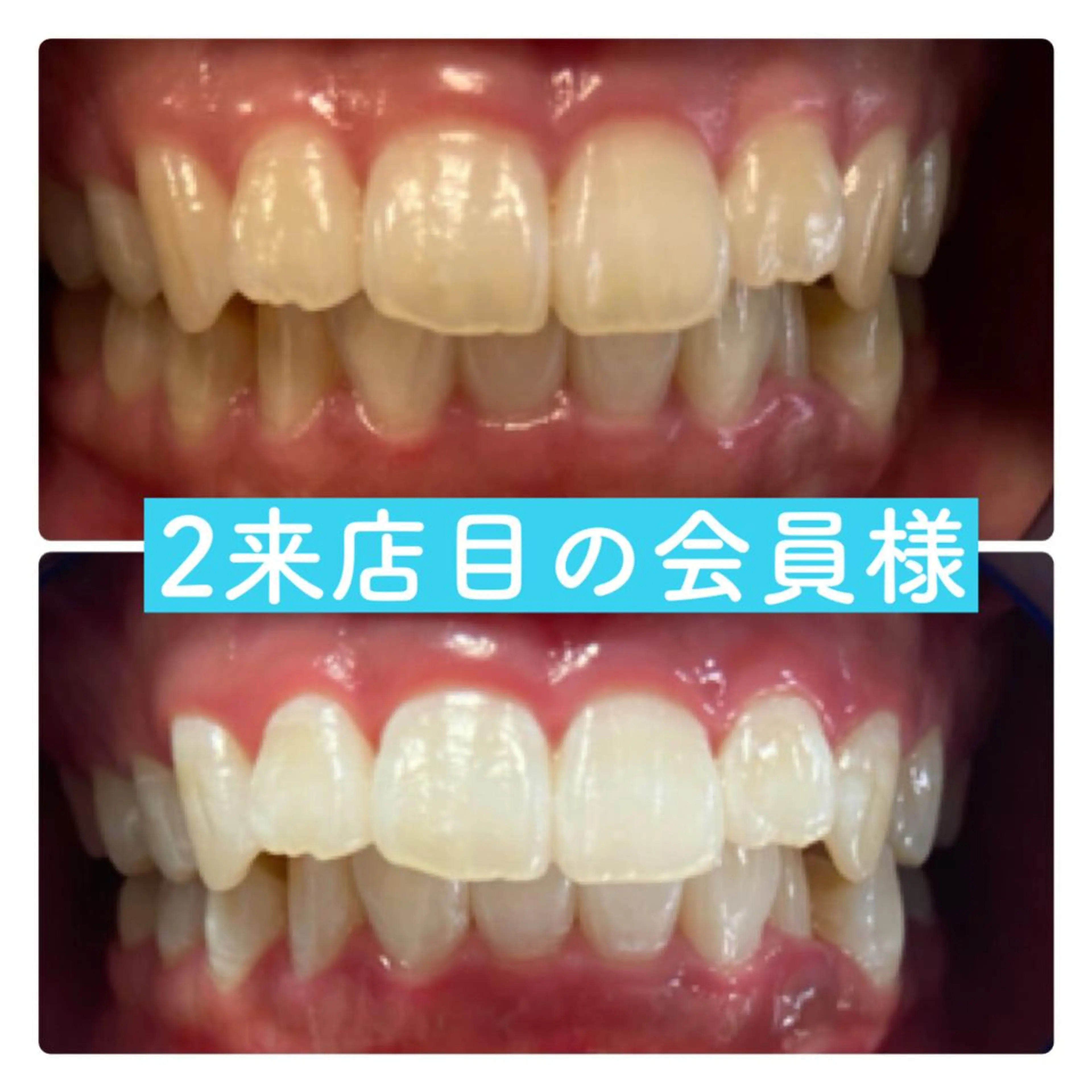 ホワイトニングルーム 横浜店のその他イメージ