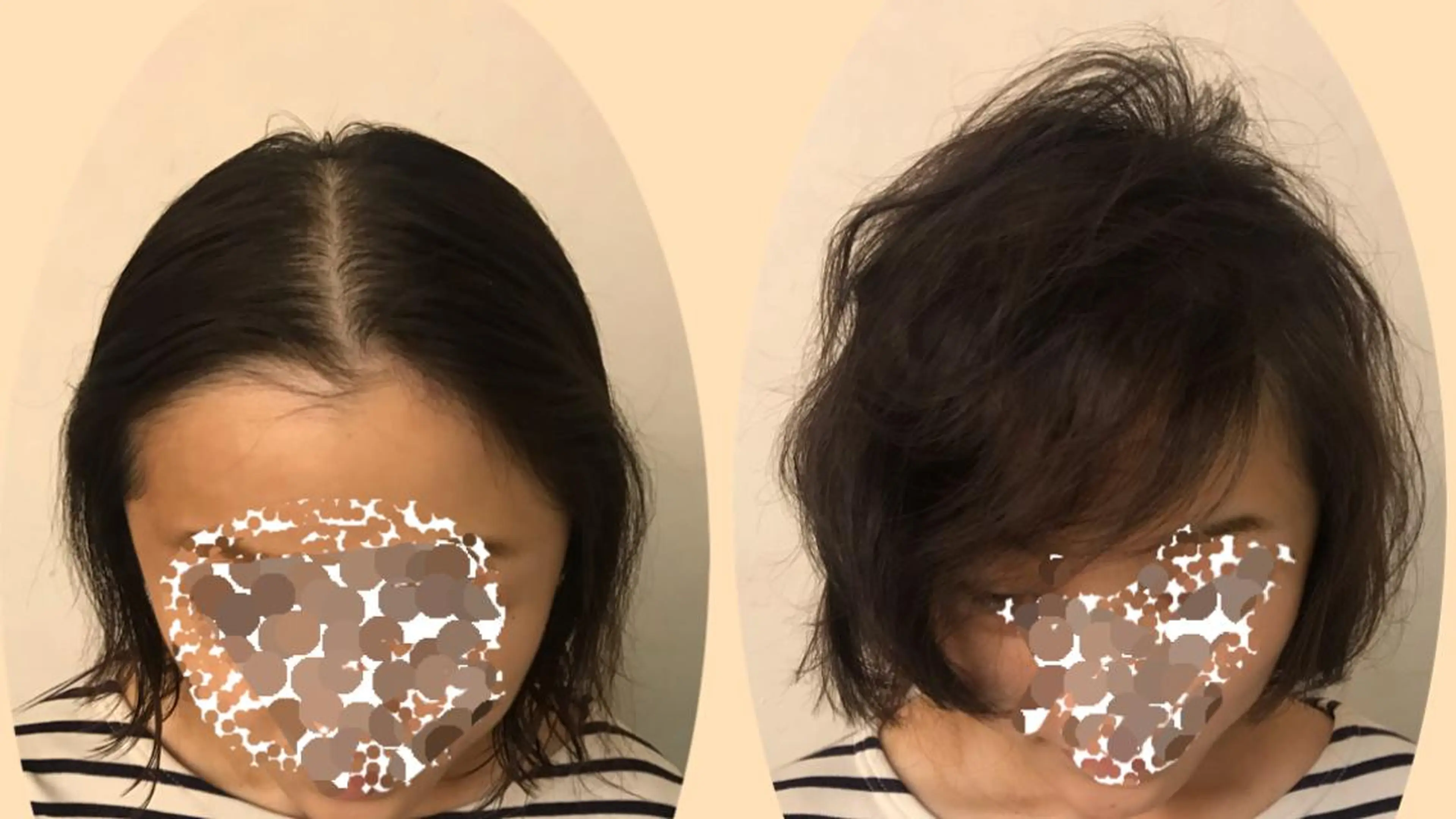 ミディアム パーマ YouTube 出演募集のその他イメージ