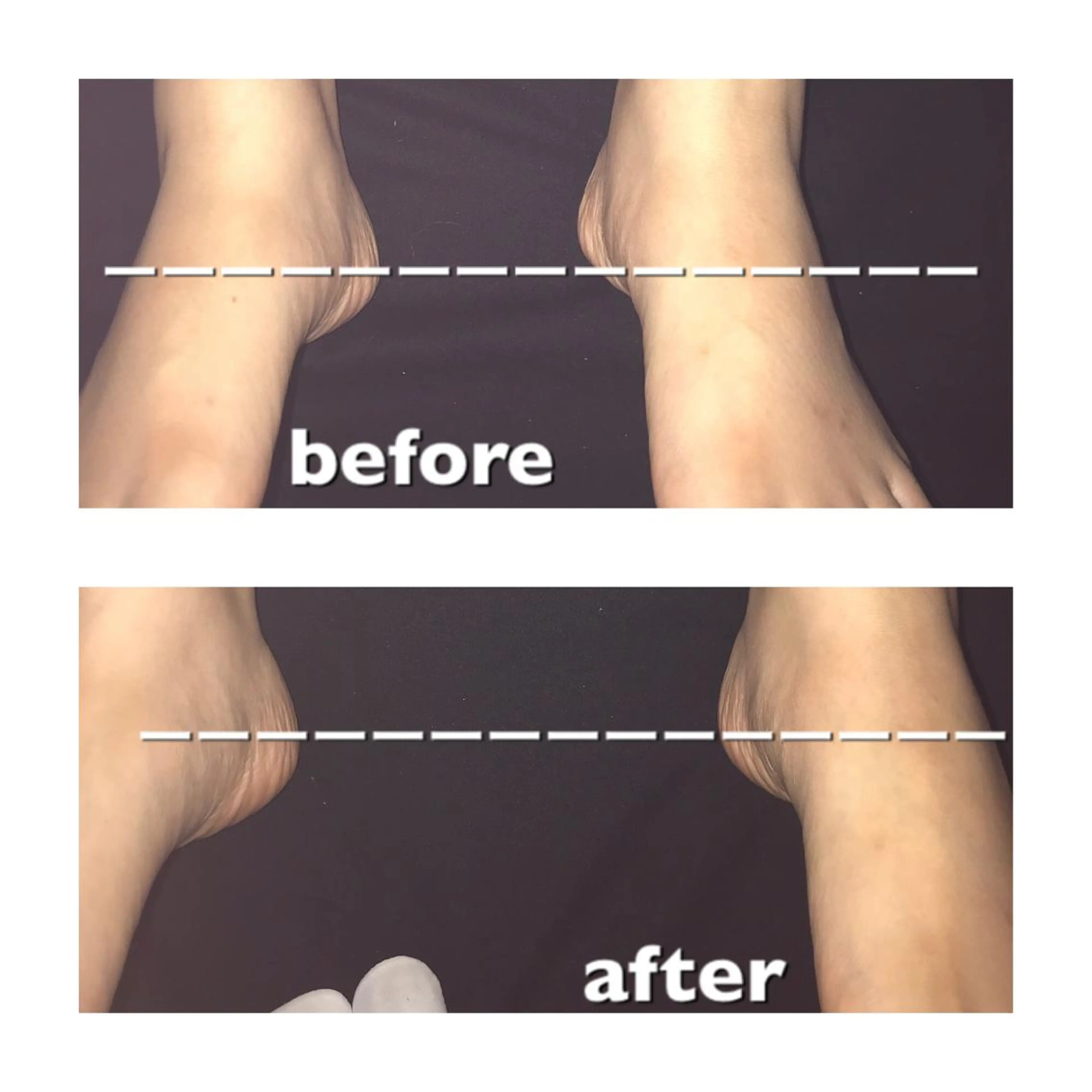 【足圧】鬼👹リンパ 身体整うサロンのエステ・リラクイメージ