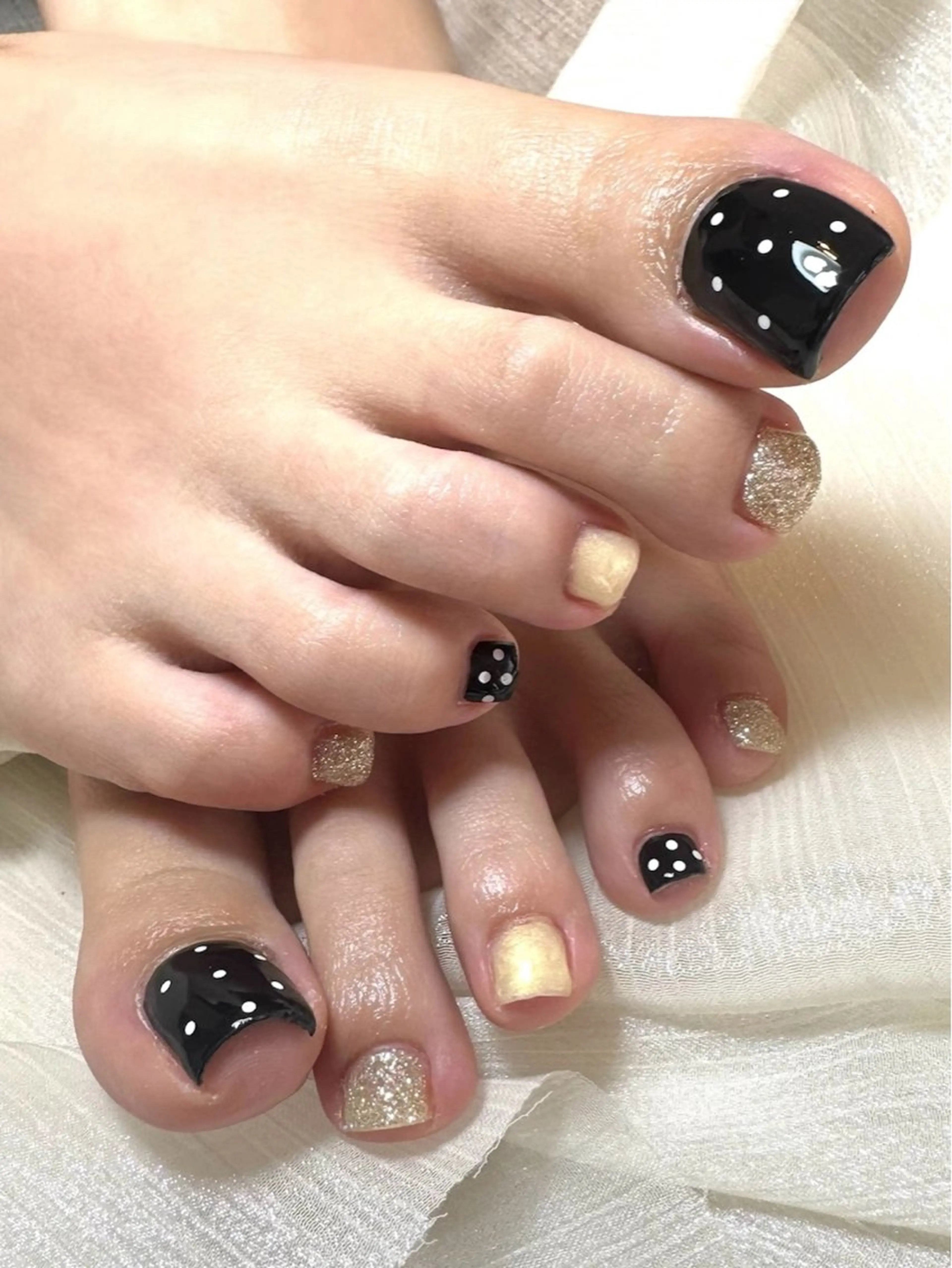 【フット】持込デザインの写真