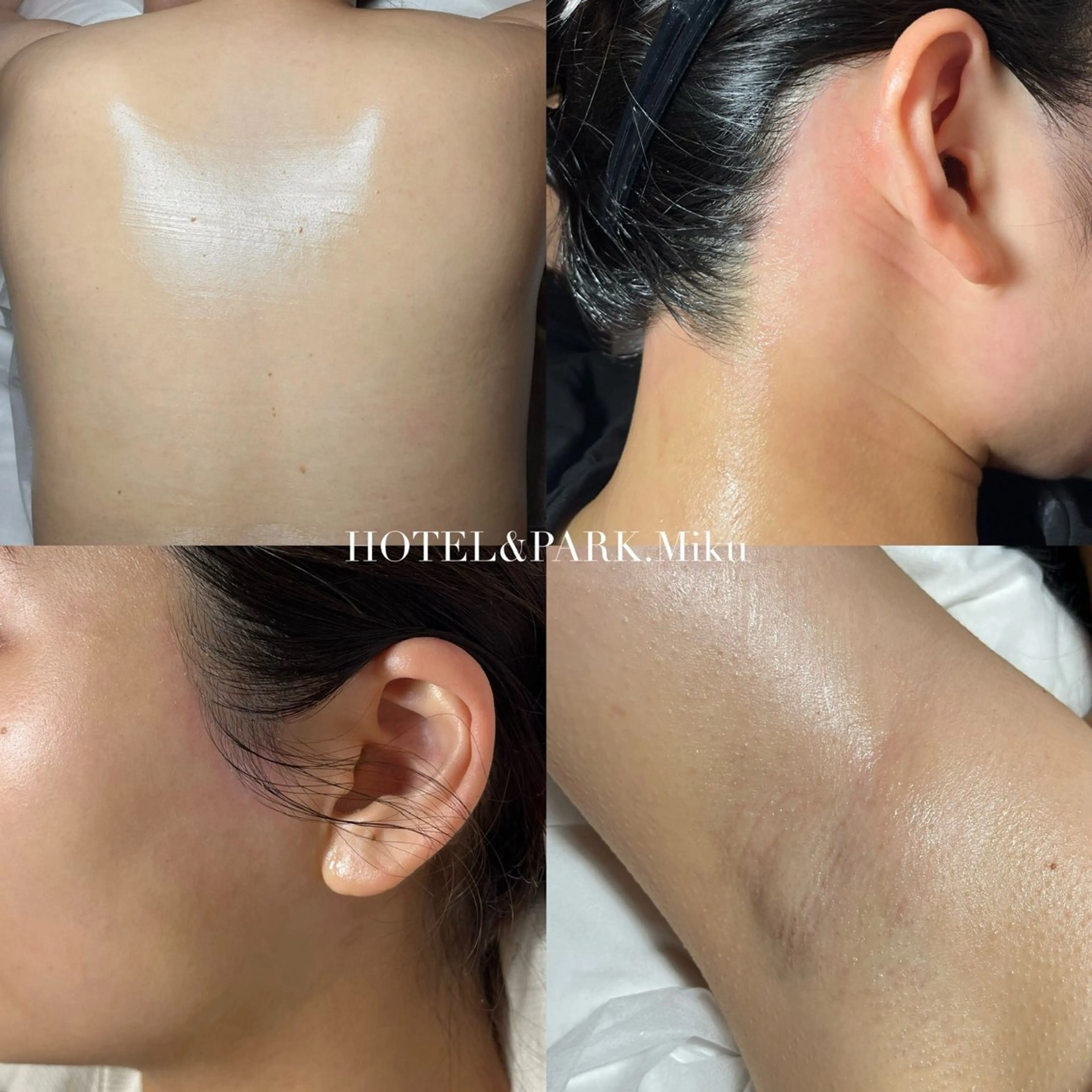 HOTEL&PARK . ワックス脱毛のエステ・リラクイメージ