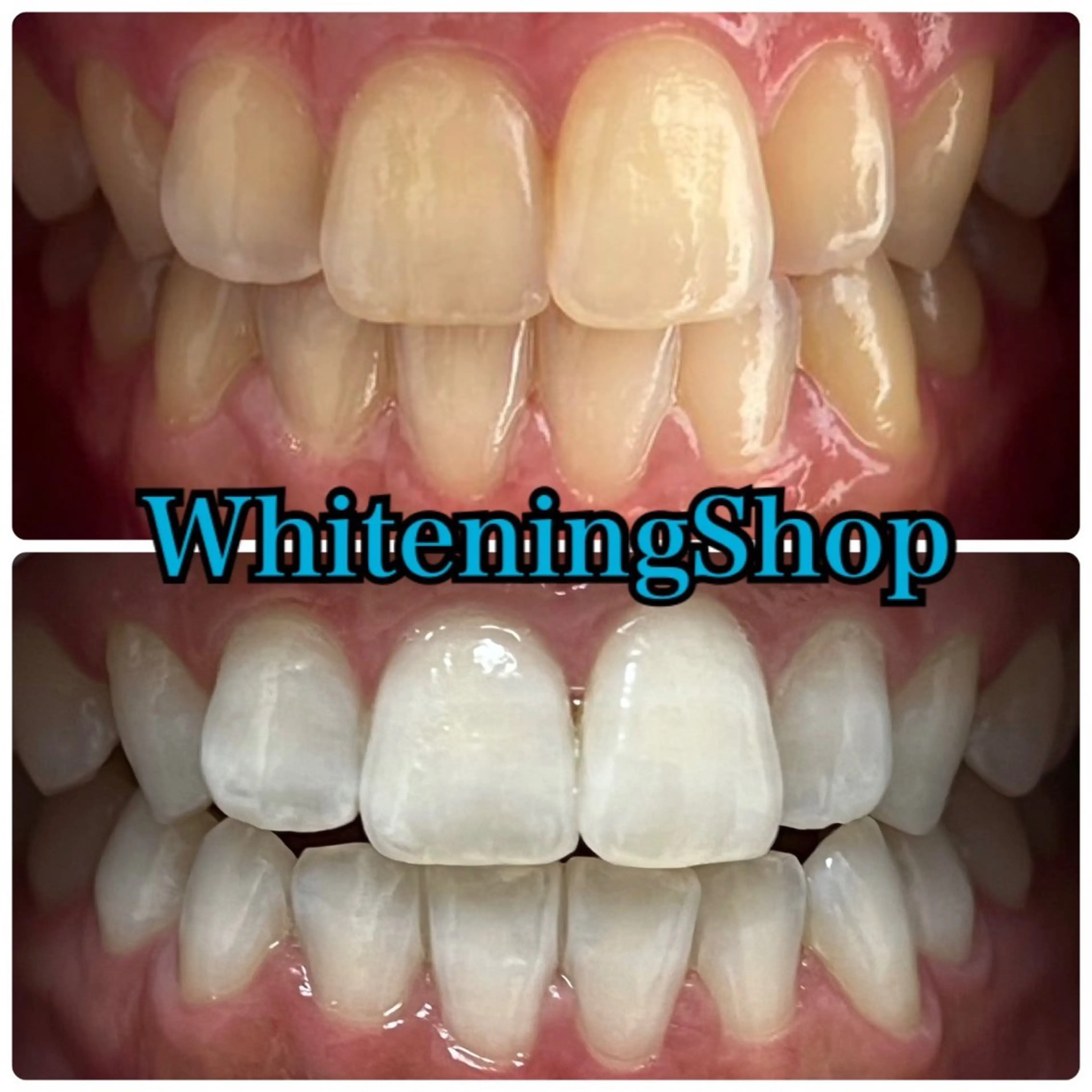 エステ リラク ホワイトニング ショップ吉祥寺店のエステ・リラクイメージ