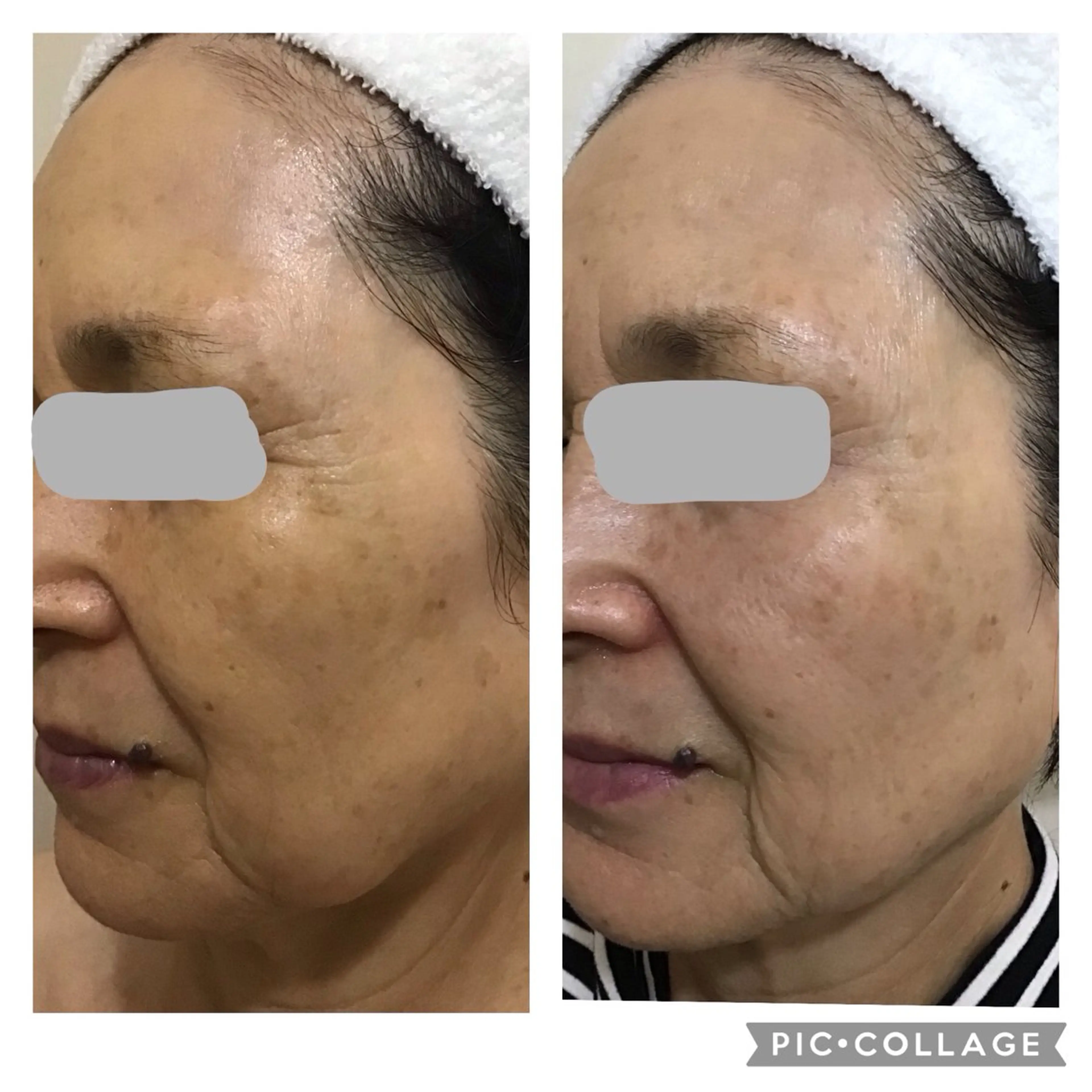 プライベートサロン LaLa 北山まいこのエステ・リラクイメージ