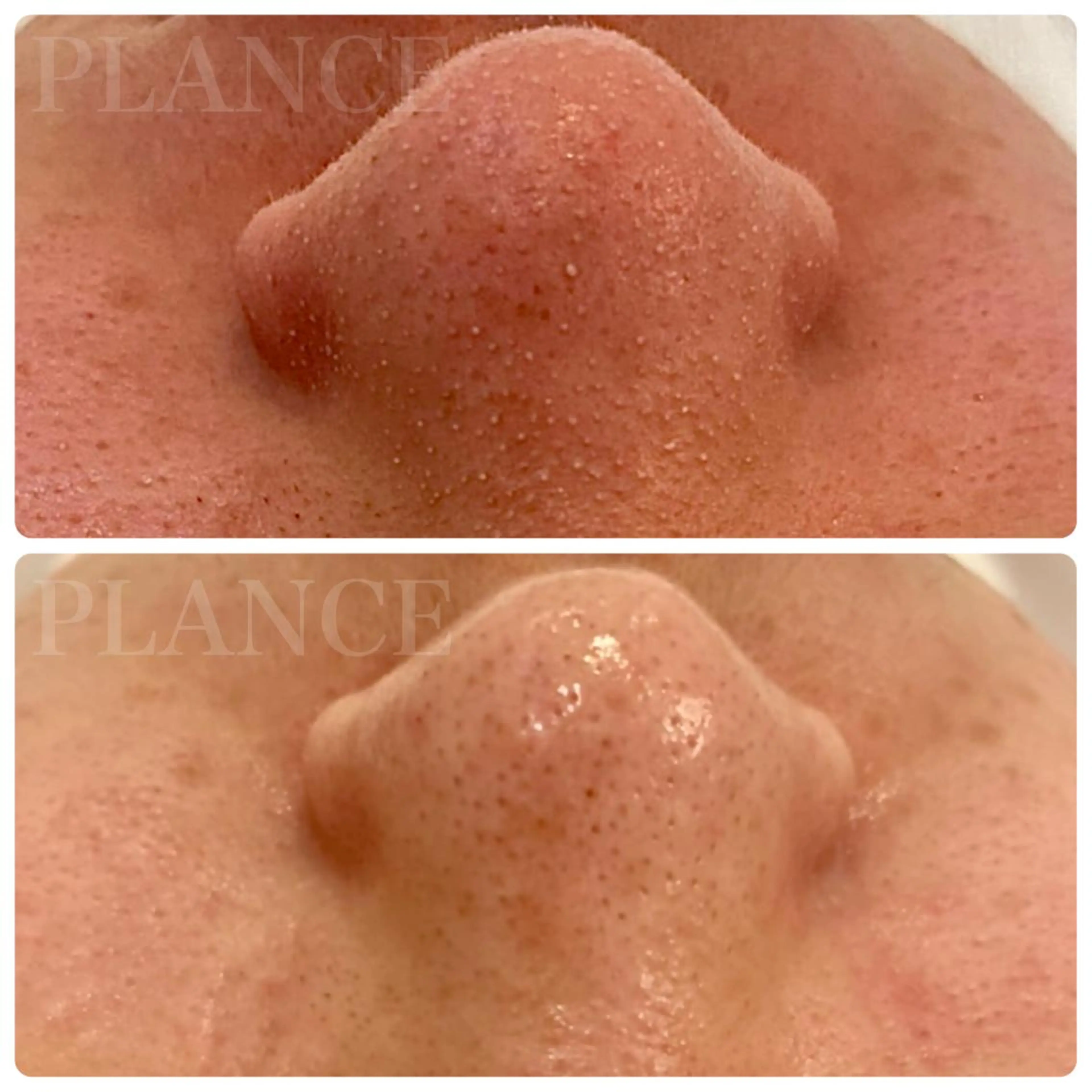 エステ フェイシャル専門 肌質改善/プランスのエステ・リラクイメージ