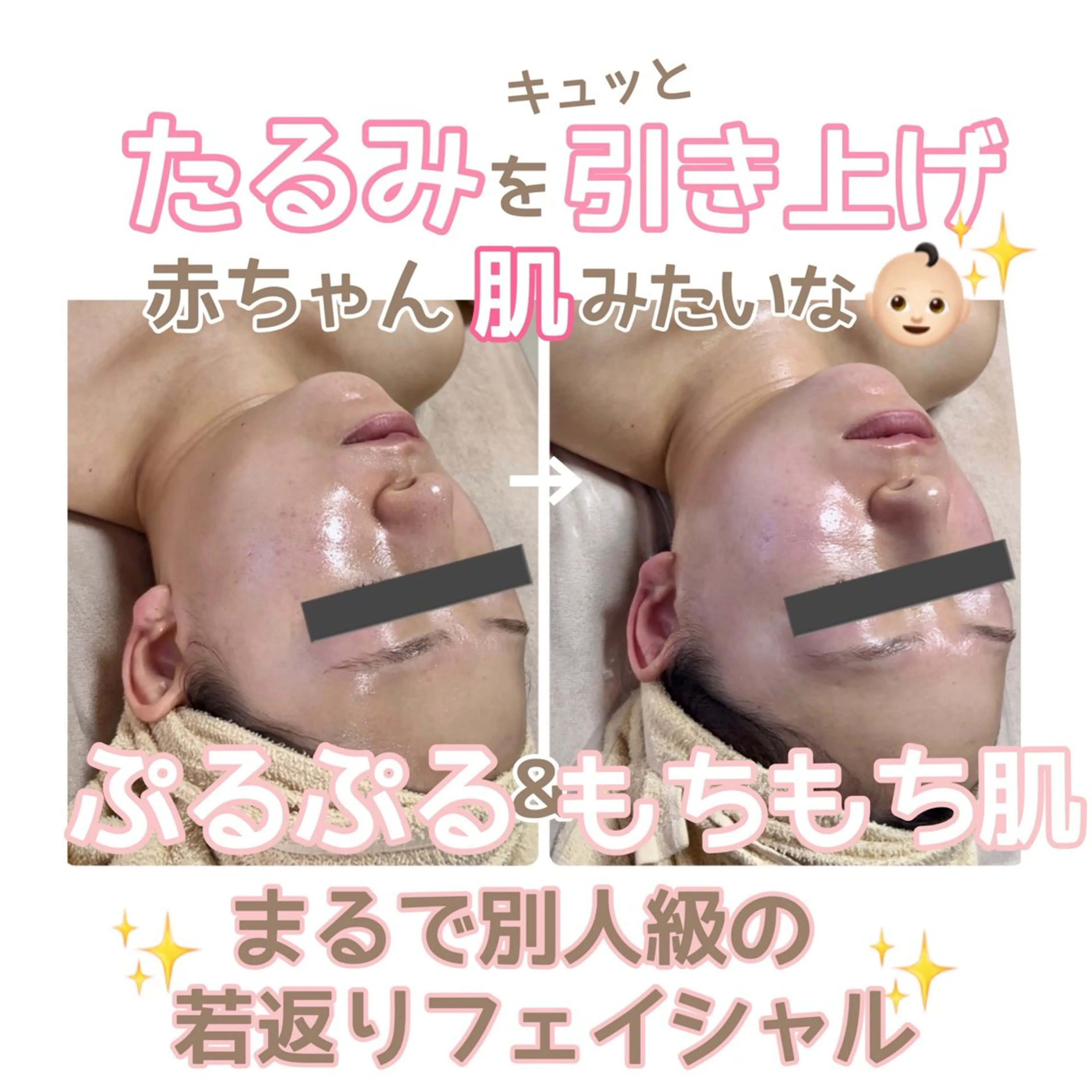 エステ stella都度払い 痩身小顔まつげパーマのマツエク・マツパデザイン