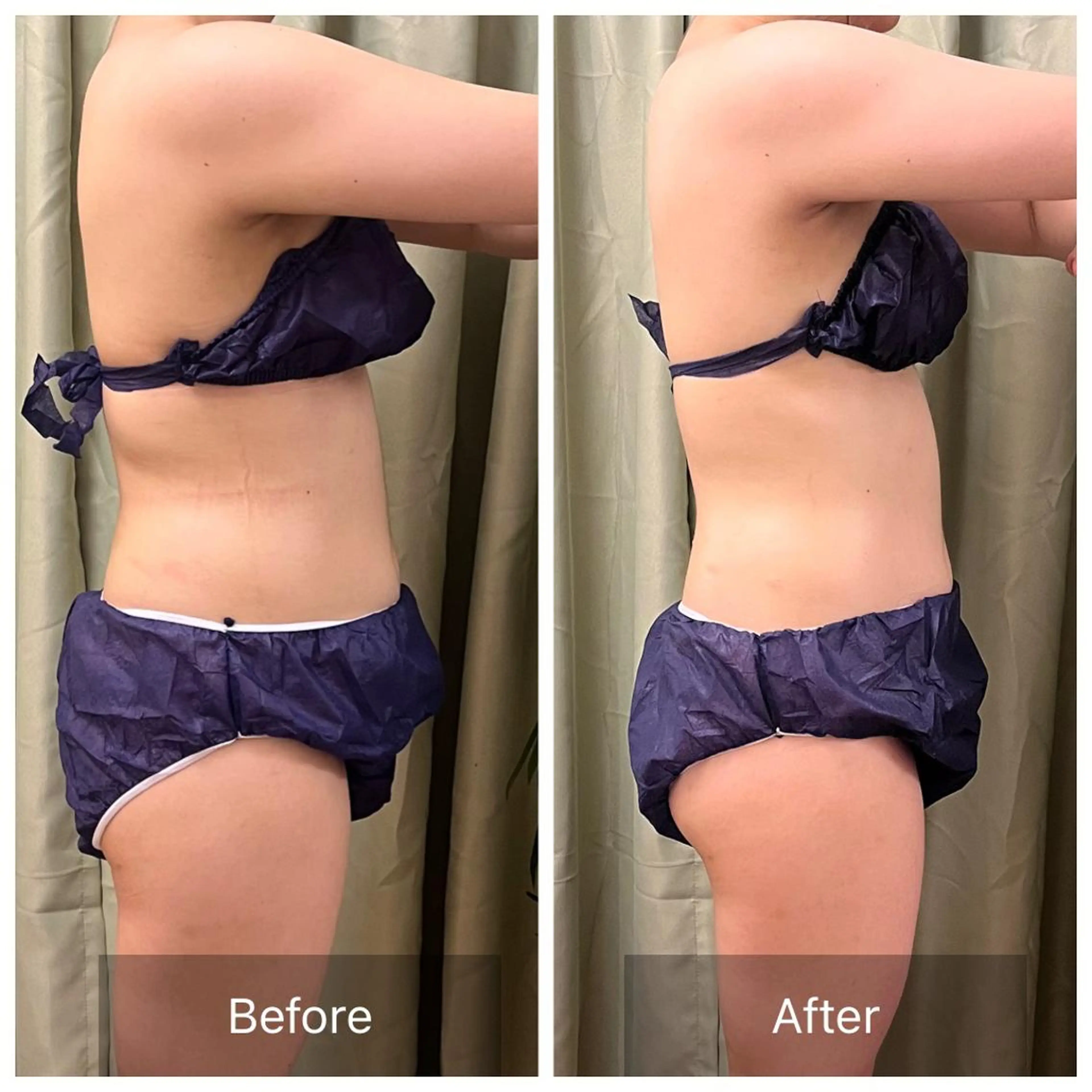 【元に戻らない】 小顔&部分痩せのその他イメージ