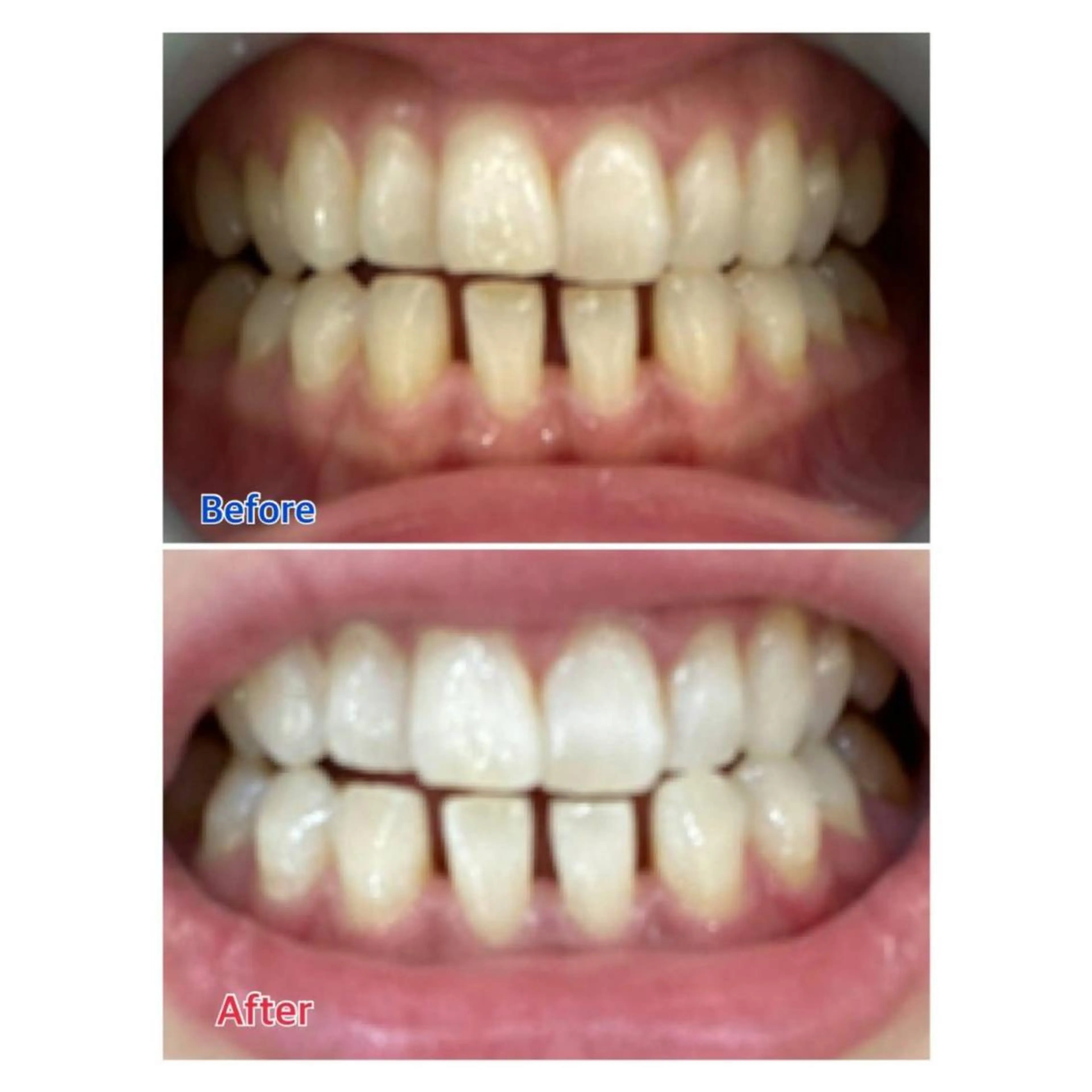 MBEAUTYSALON 千葉店・京成大久保所属・Melty 輝のその他イメージ