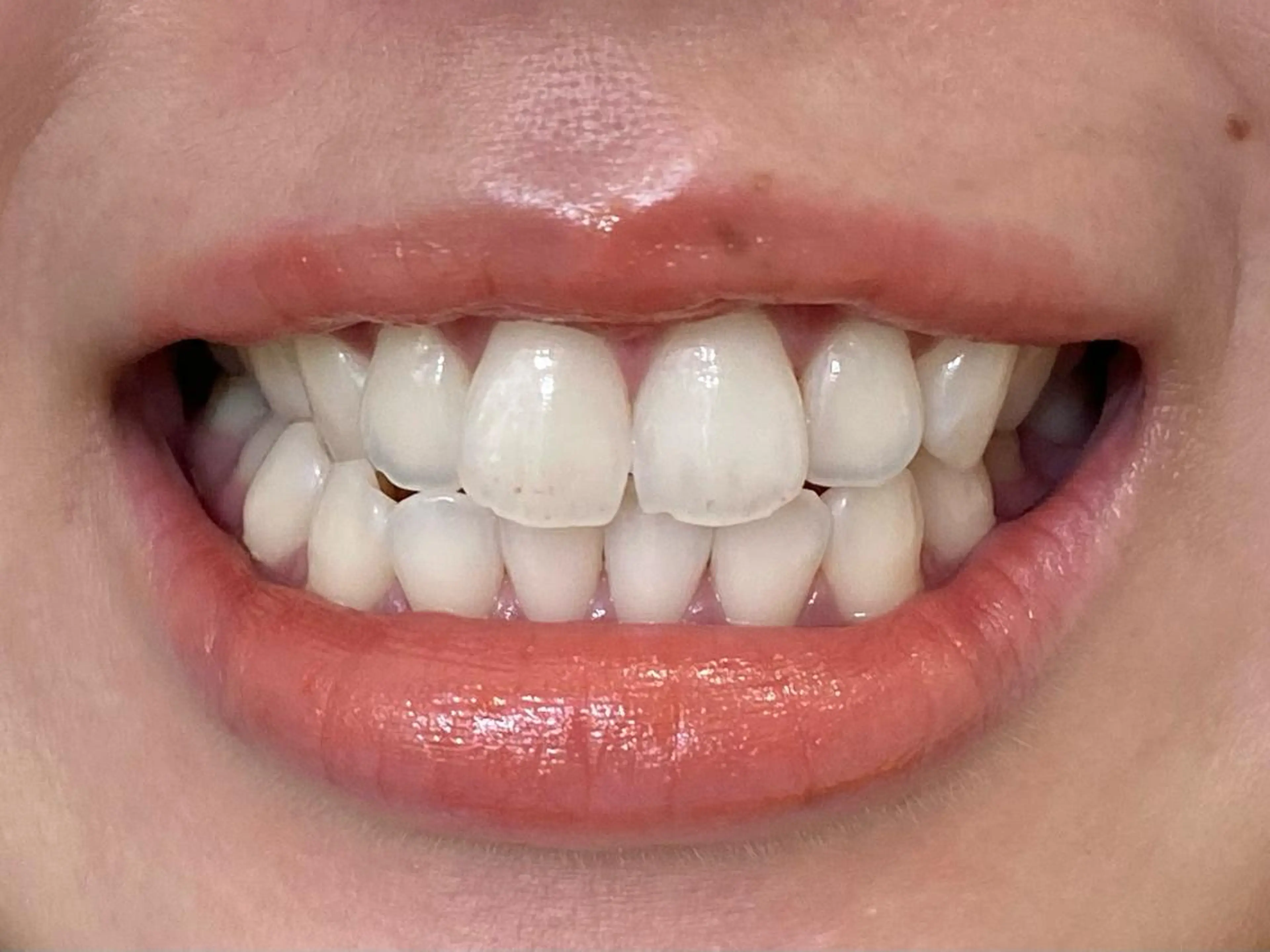 その他 ホワイトニングサロン La vie enのその他イメージ