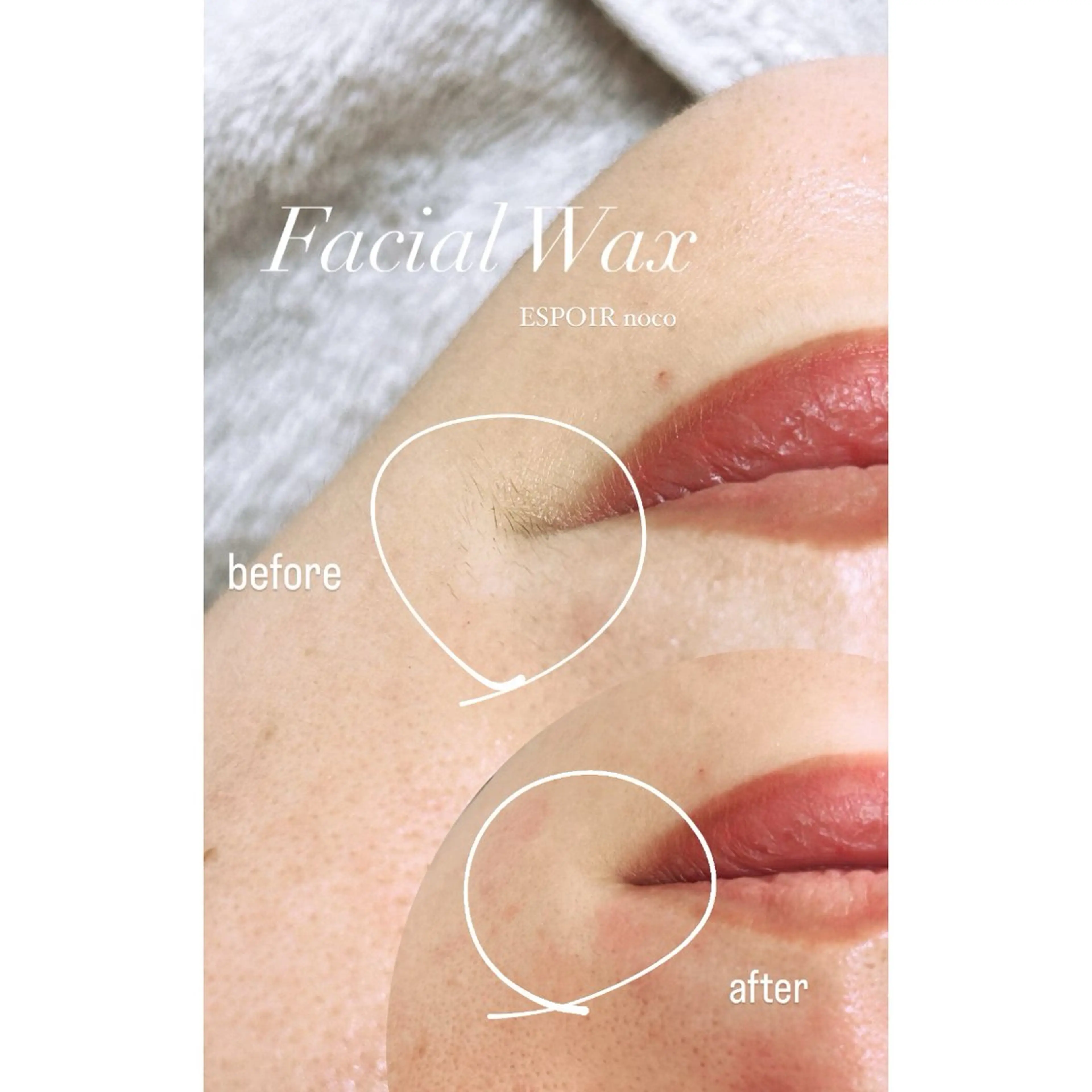 ワックス脱毛🌈 ESPOIRnocoのエステ・リラクイメージ