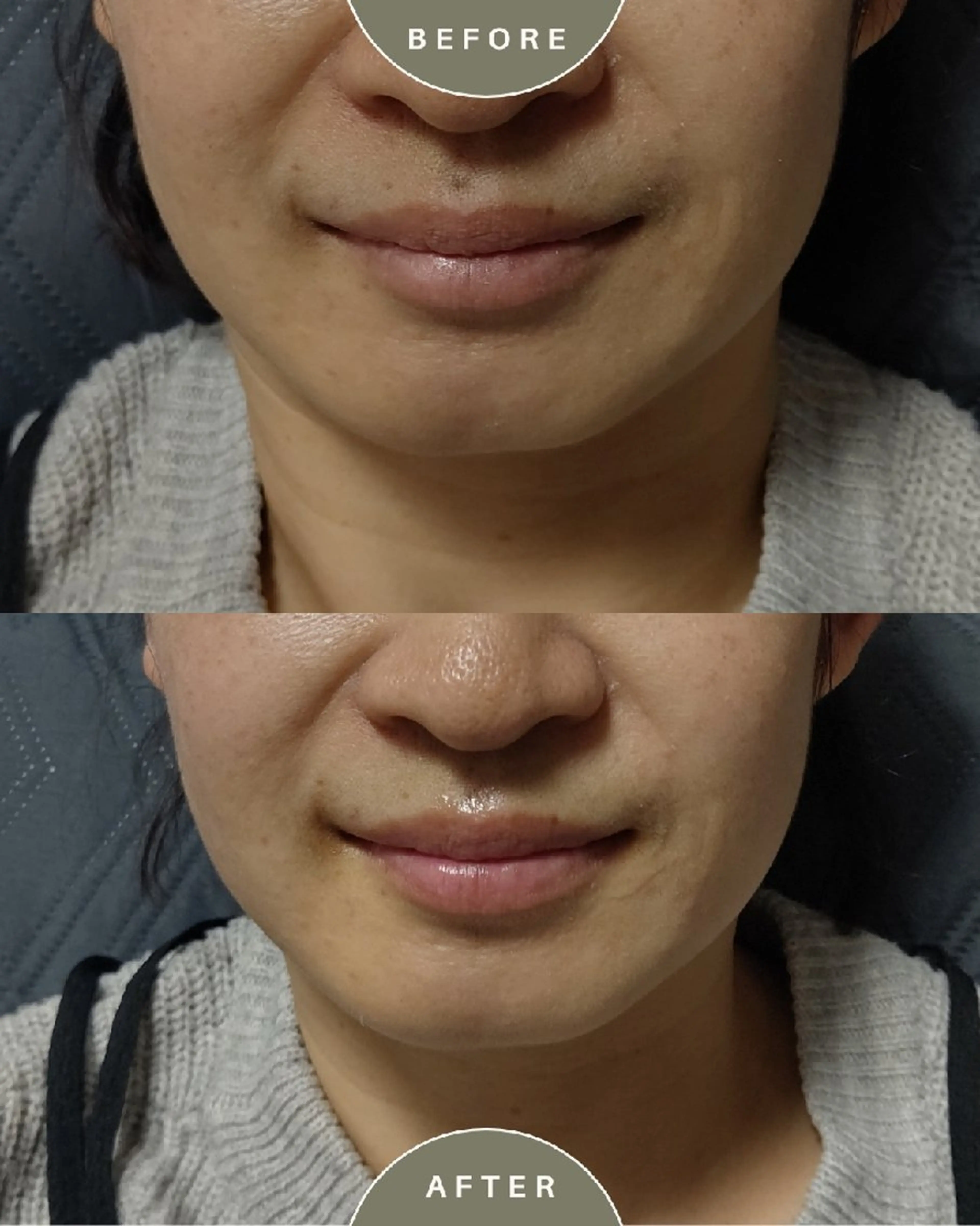 リラク はなえみの森 上戸千瑞のエステ・リラクイメージ