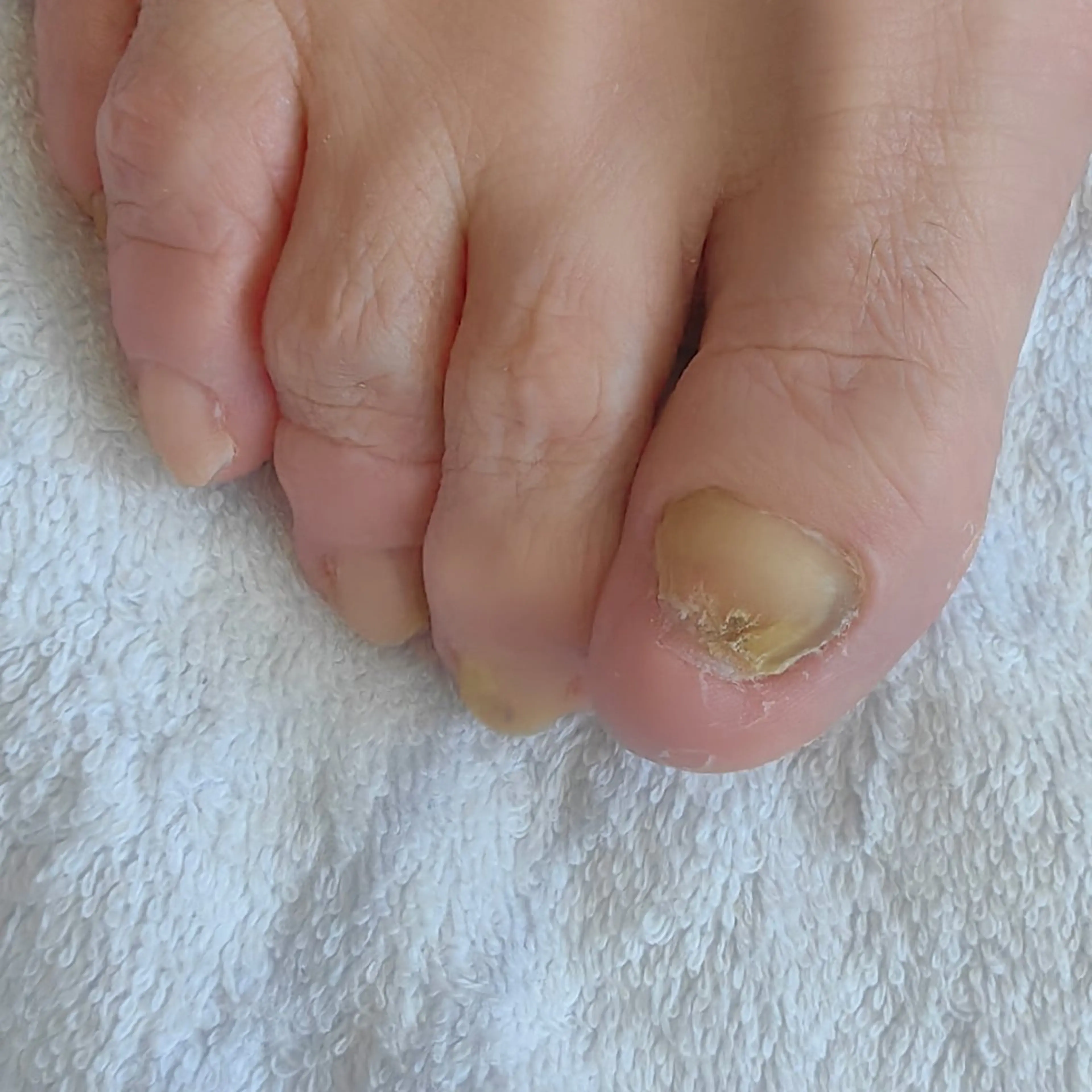 ネイル フットネイル reve あやののネイルデザイン