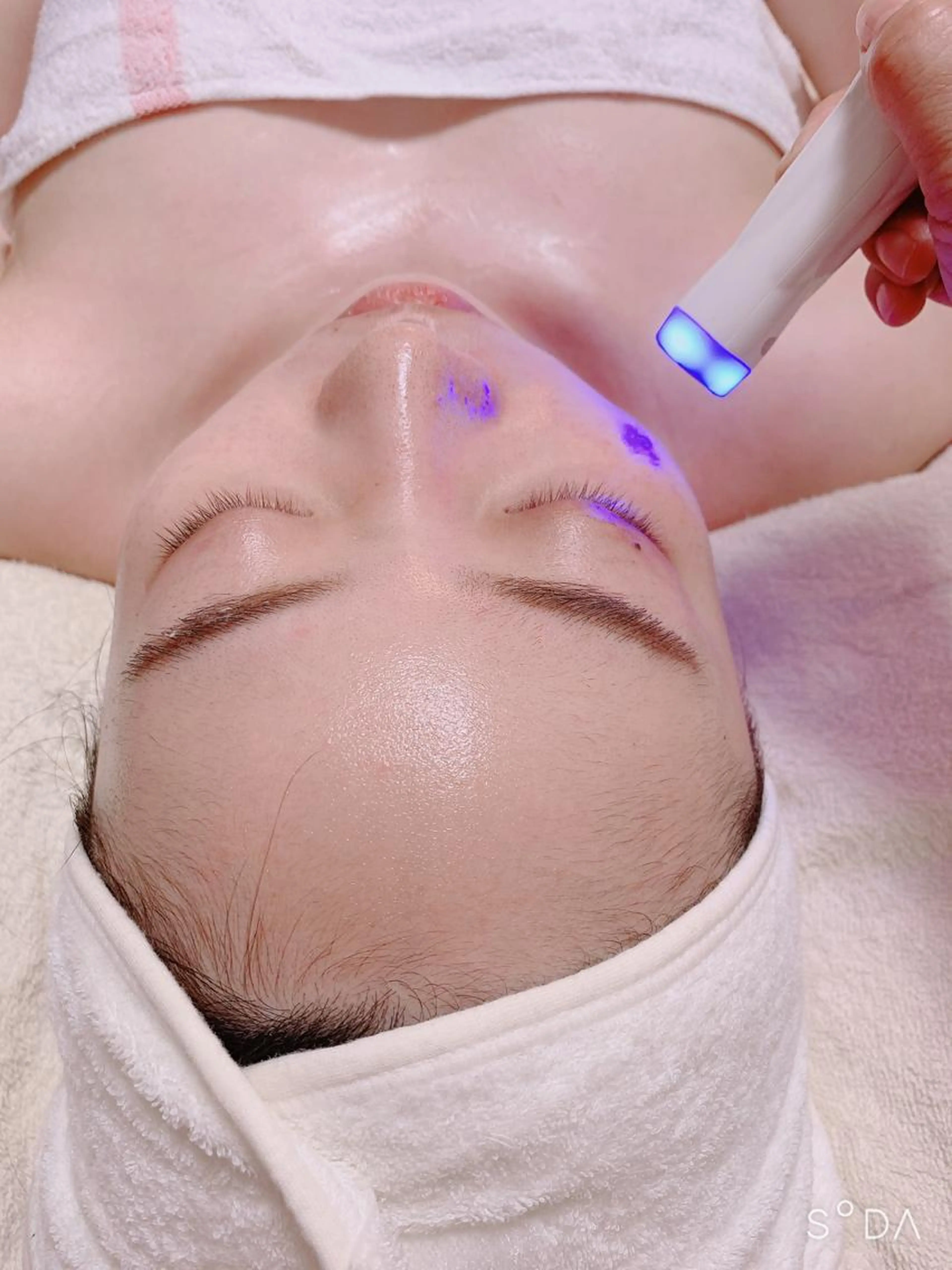 🔹デコルテフェイシャル🔹💛人気💛🎀ラジオ波エステ🎀✨小顔✨ハリアップ✨引き締め✨ラジオ波フェイシャルエステの写真