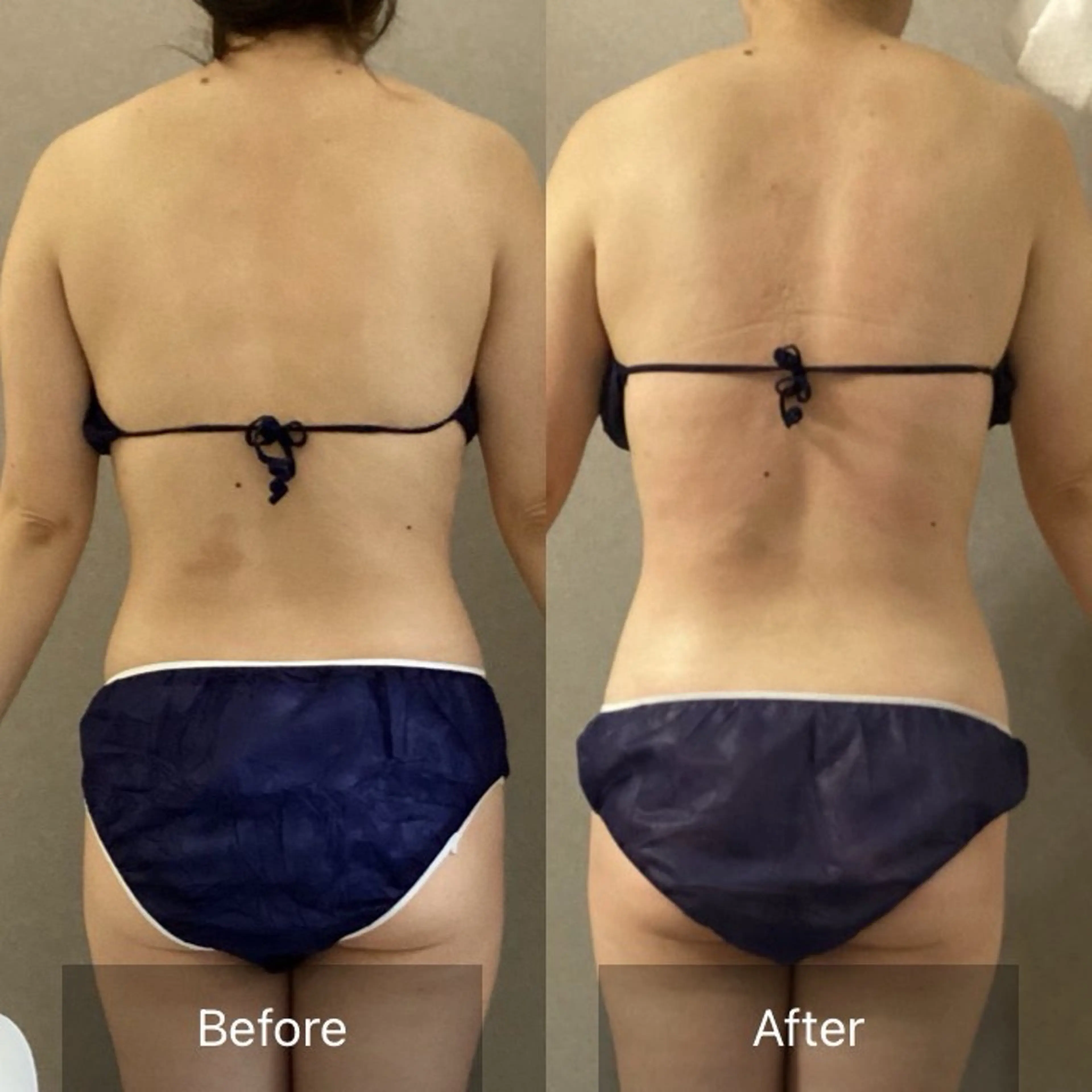 エステ 美と健康サロンLinoLea所属・美と健康サロン Lino leaのエステ・リラクイメージ