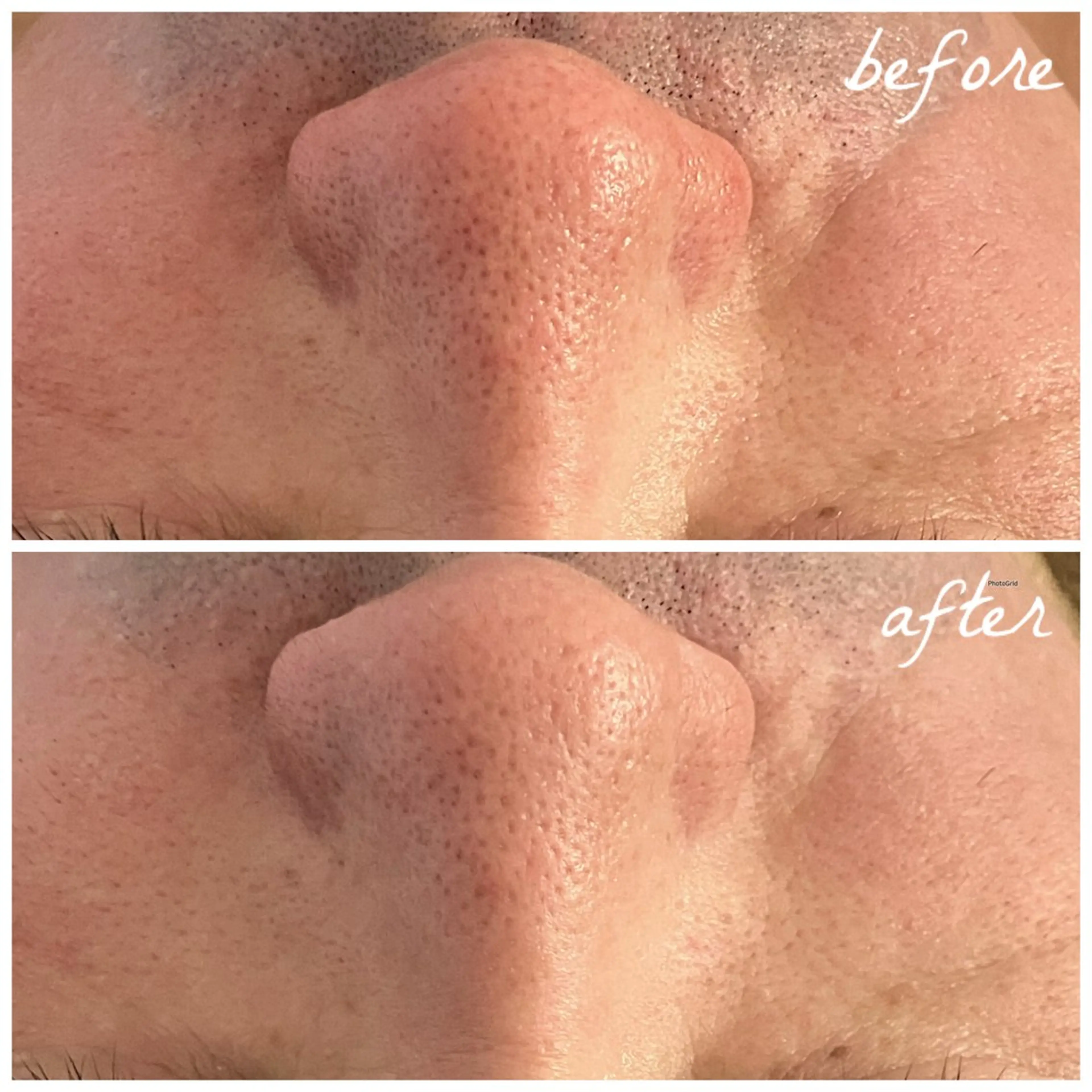 メンズ エステ メナード岐阜市茜部 杉浦のエステ・リラクイメージ