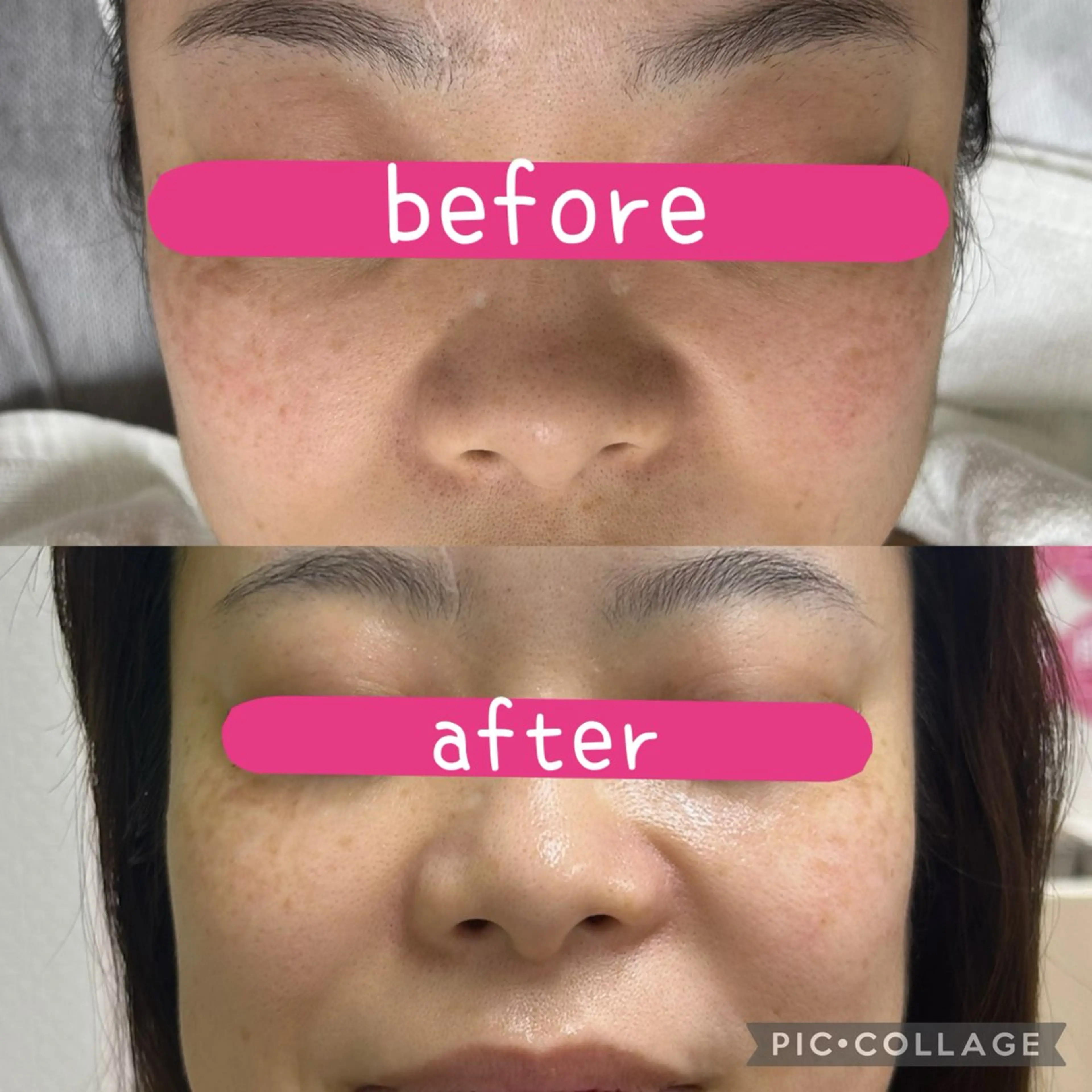 自爪育成× 肌質改善サロンのネイルデザイン