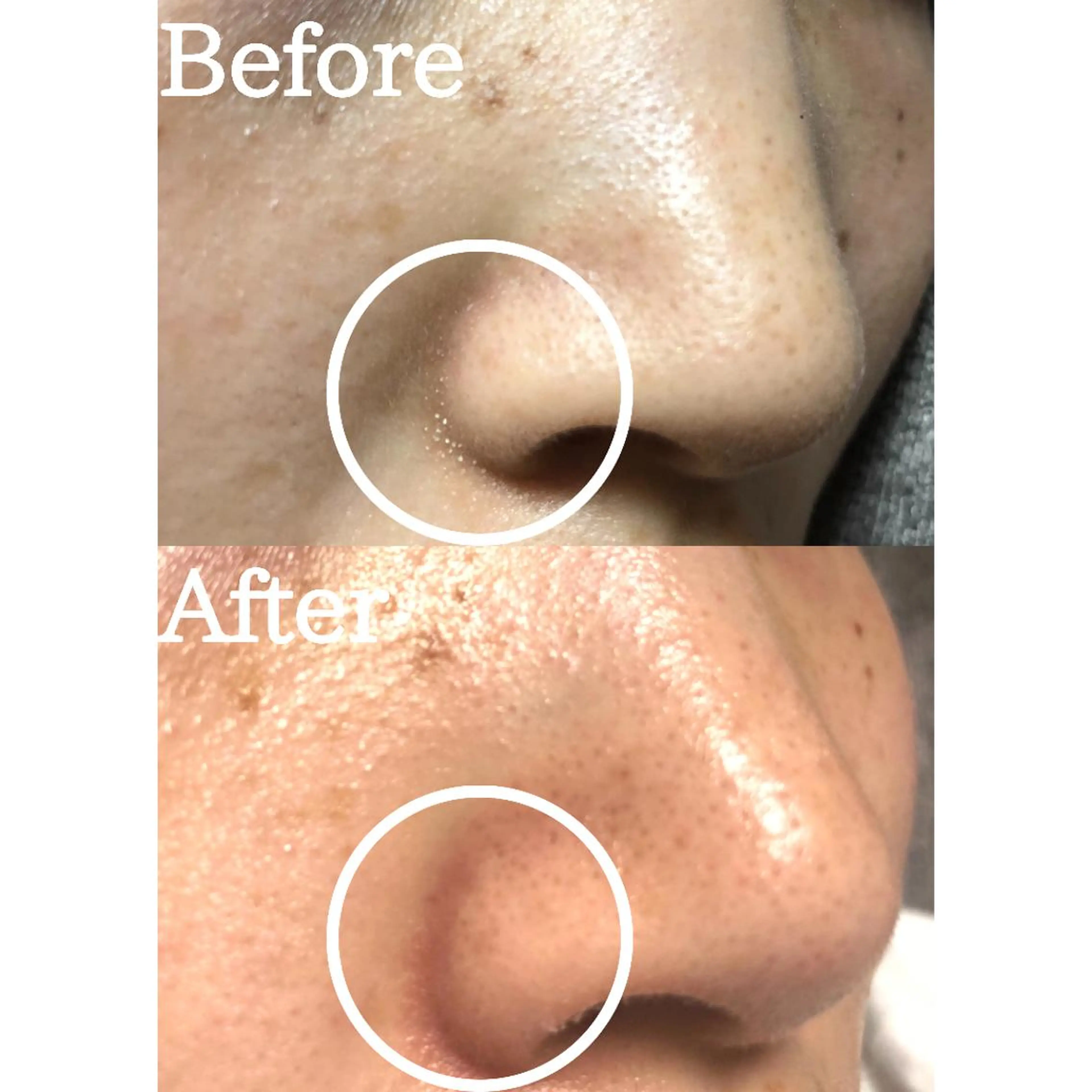 BestBelleꕤ 大阪福島/肌質改善のエステ・リラクイメージ