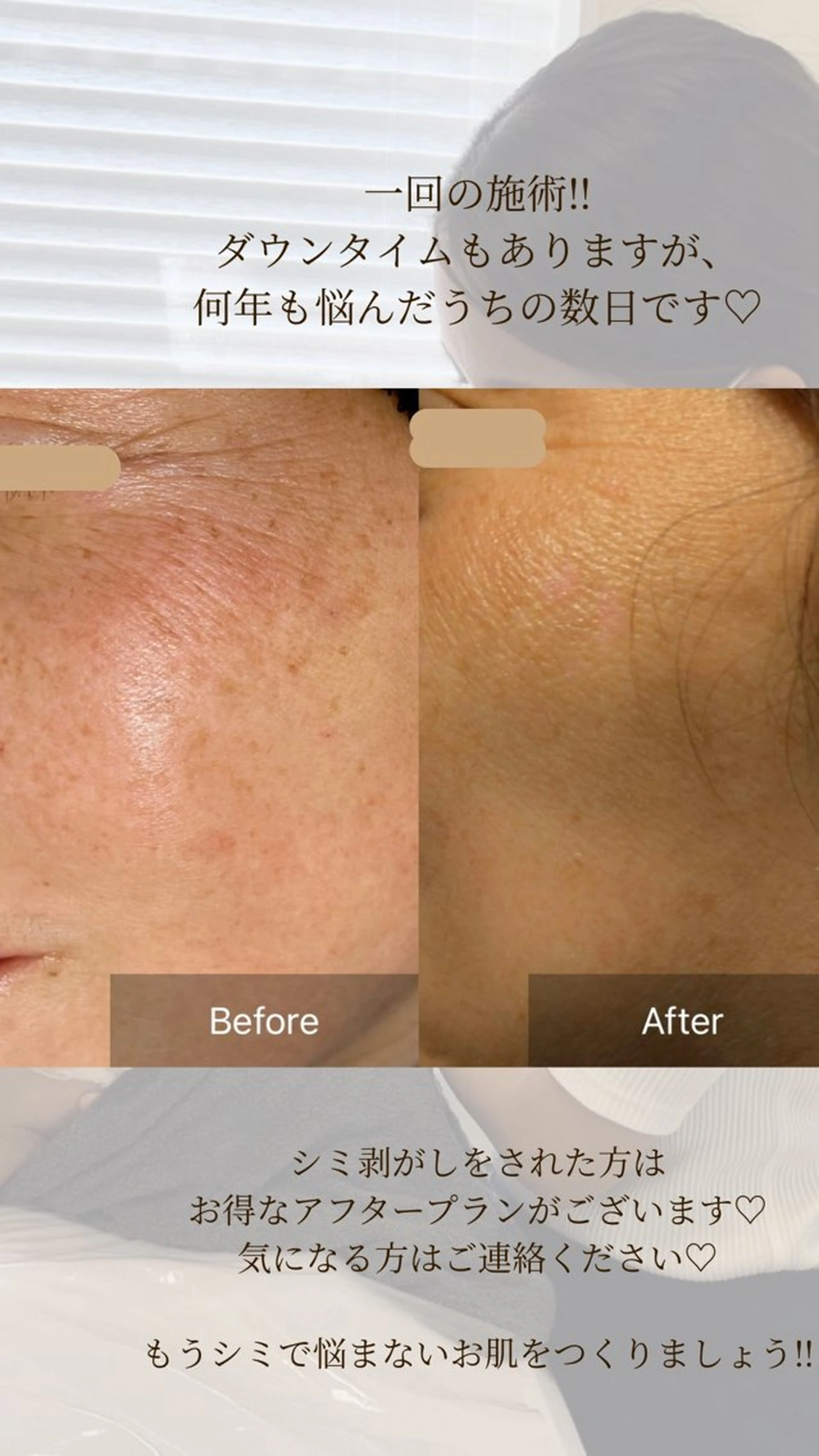 毛穴が見えなくなるサロン  Horo所属・岡 えり子のエステ・リラクイメージ