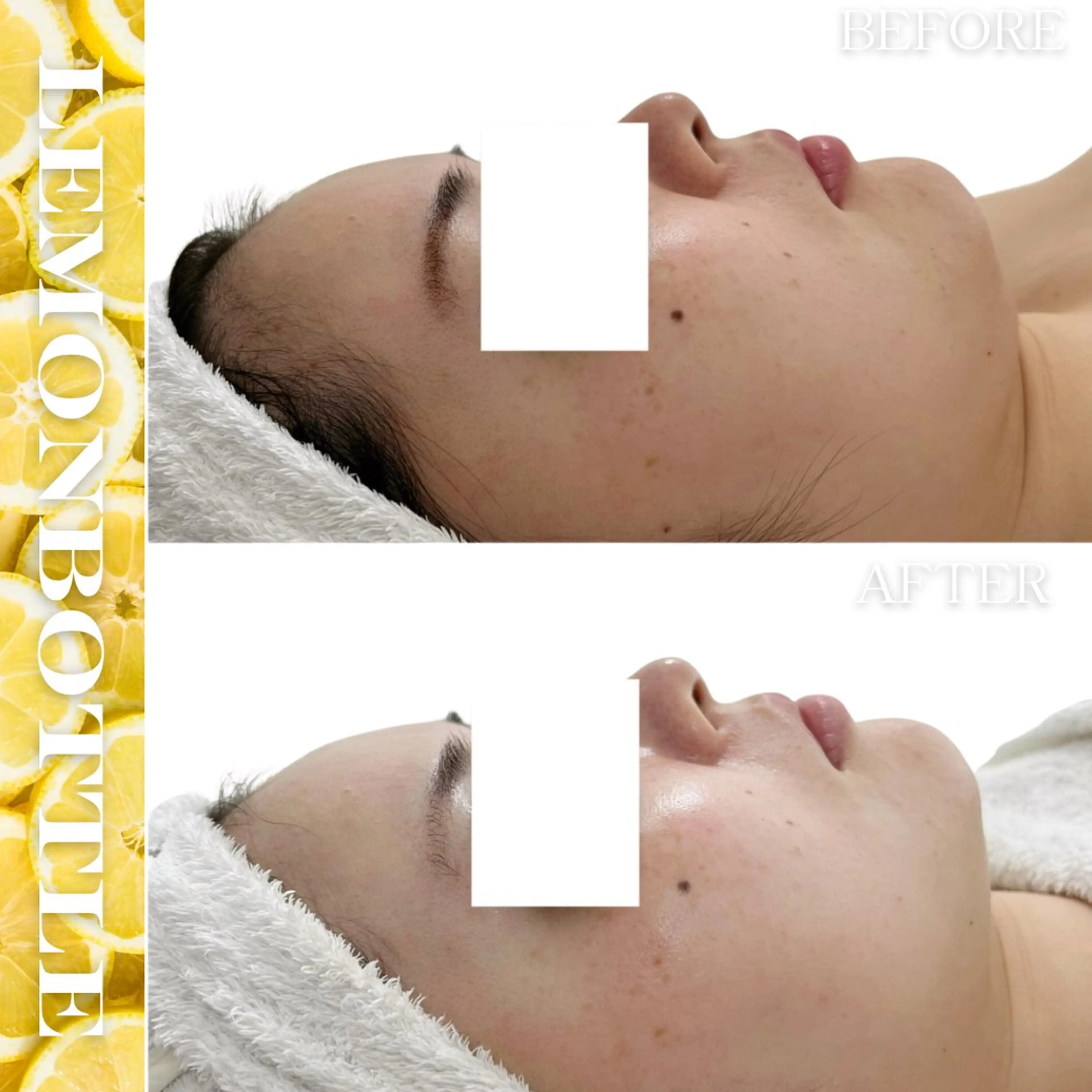 LiAm《美肌管理/ 小顔/脂肪ケア》のその他イメージ