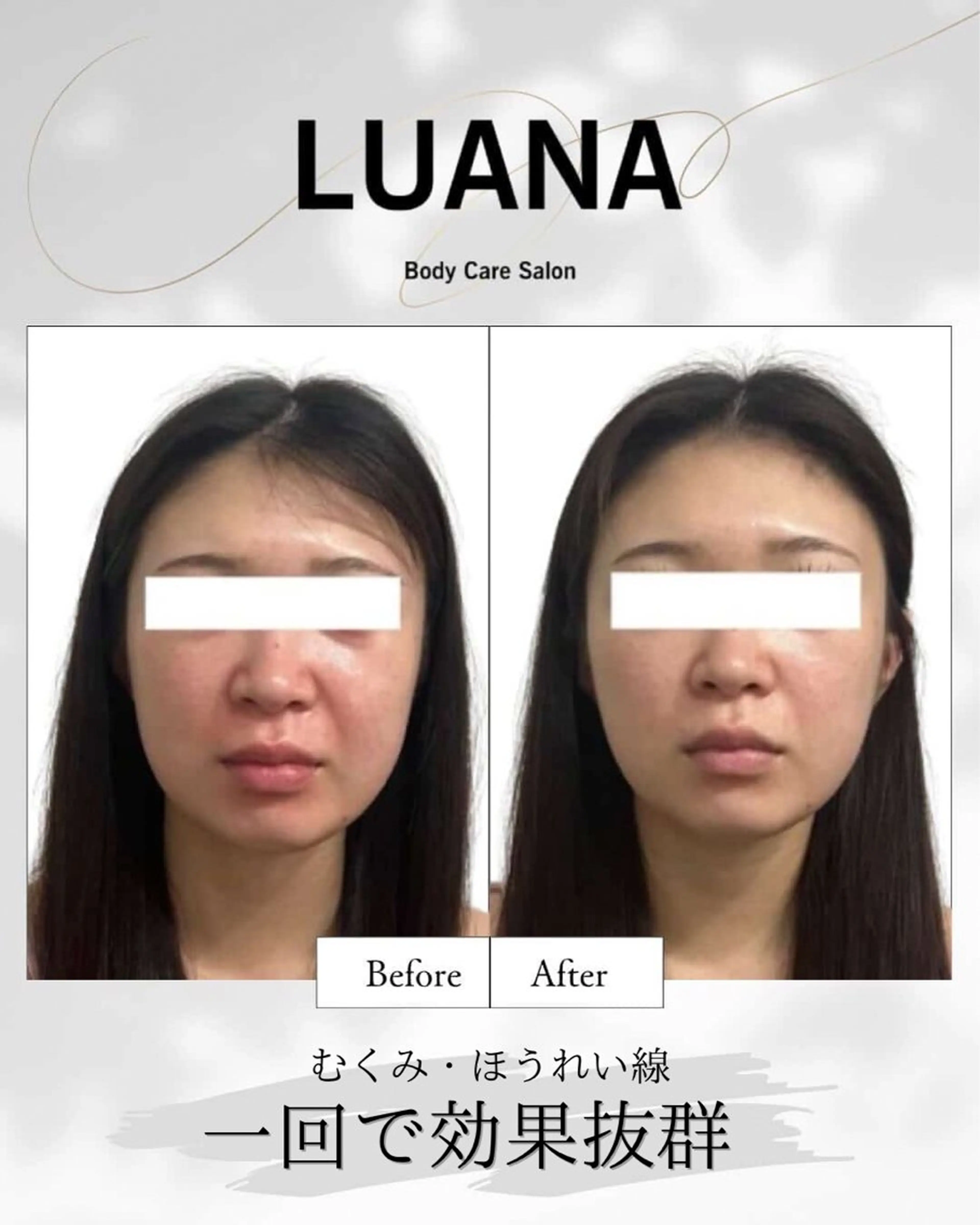 エステ リラク LUANA/小顔整体 men's脱毛のその他イメージ