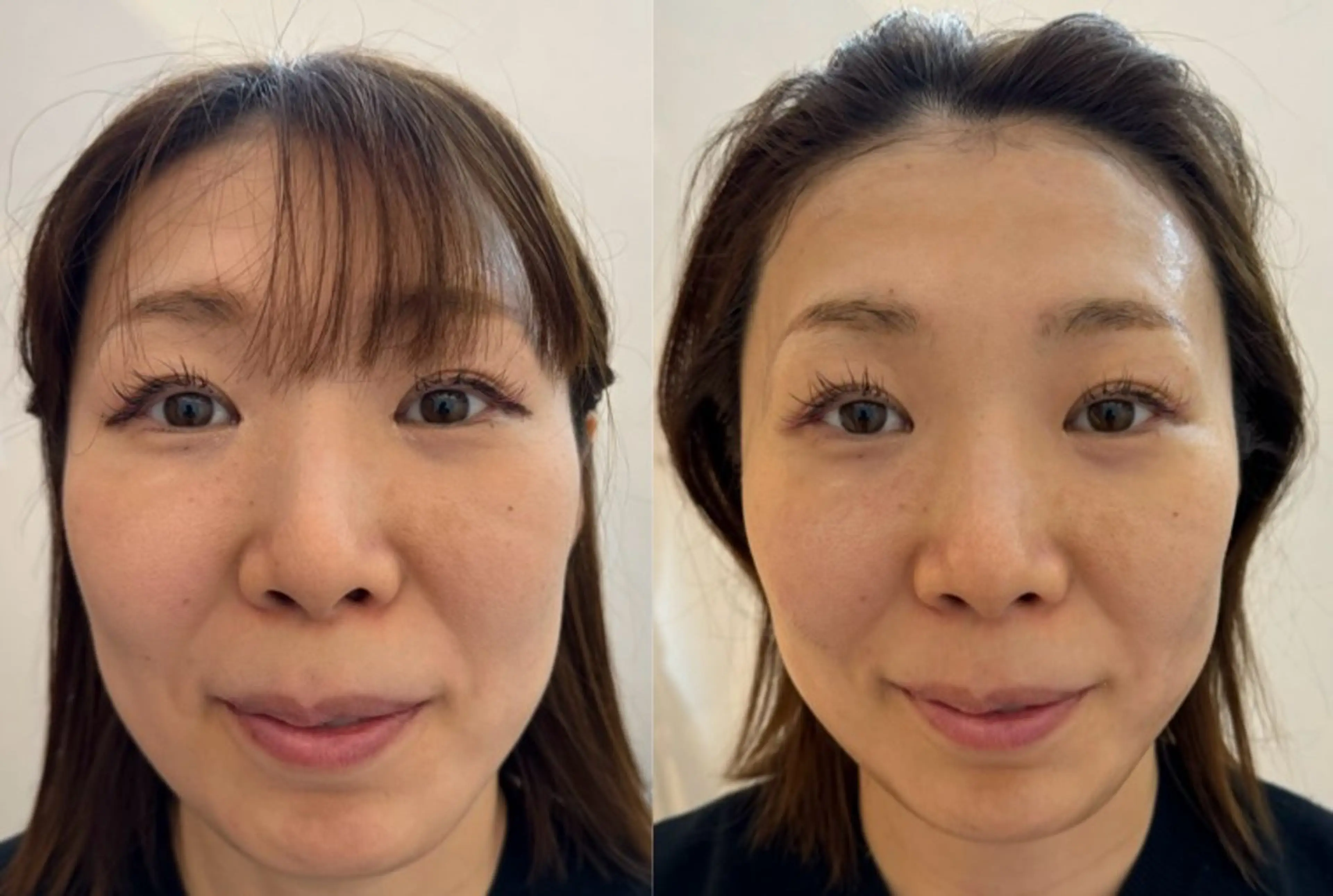 【福岡市西区 エステ】 GRANVIR(グランヴィール)所属・GRANVIR グランヴィールのエステ・リラクイメージ