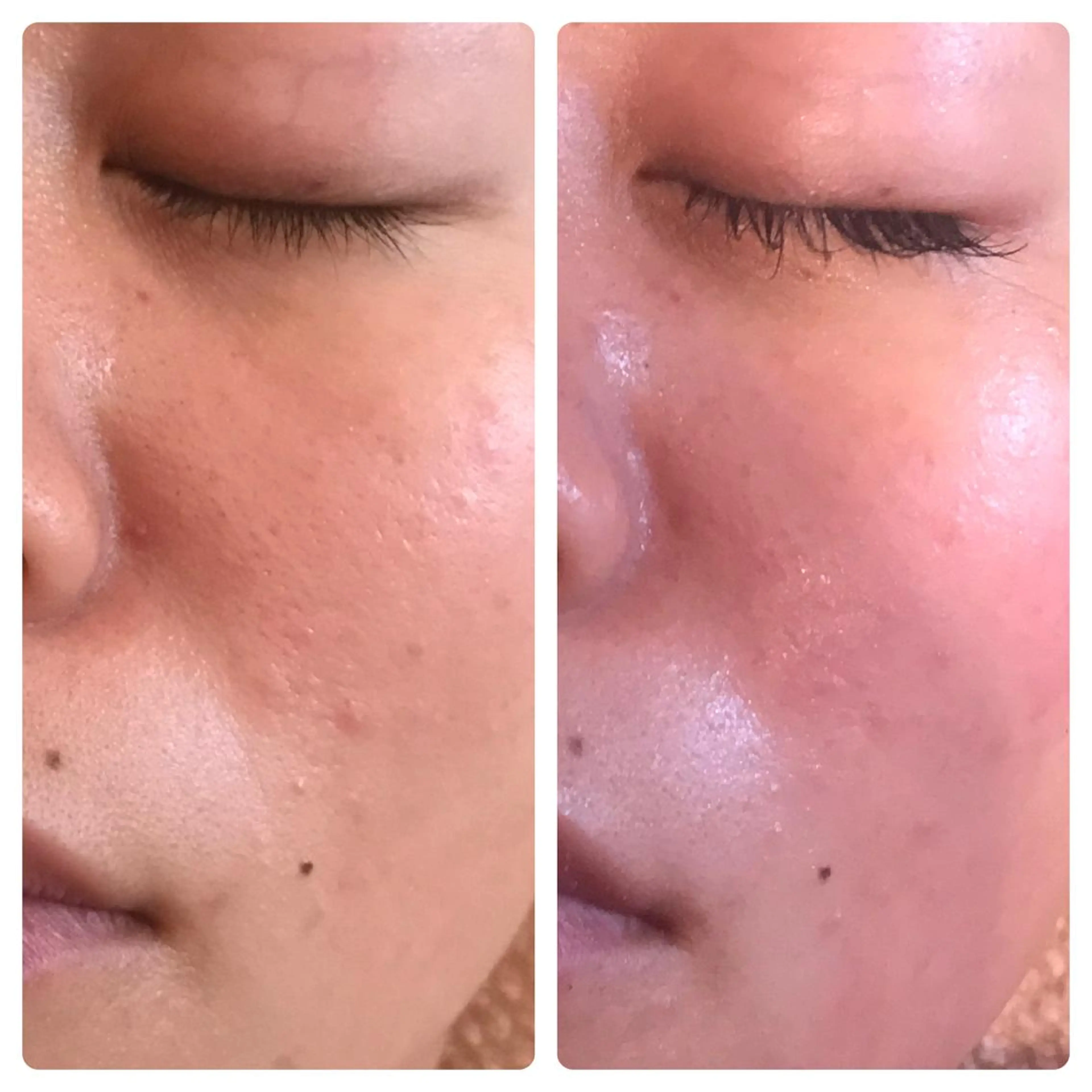 フェアリーローズ所属・fairyrose organicエステのエステ・リラクイメージ