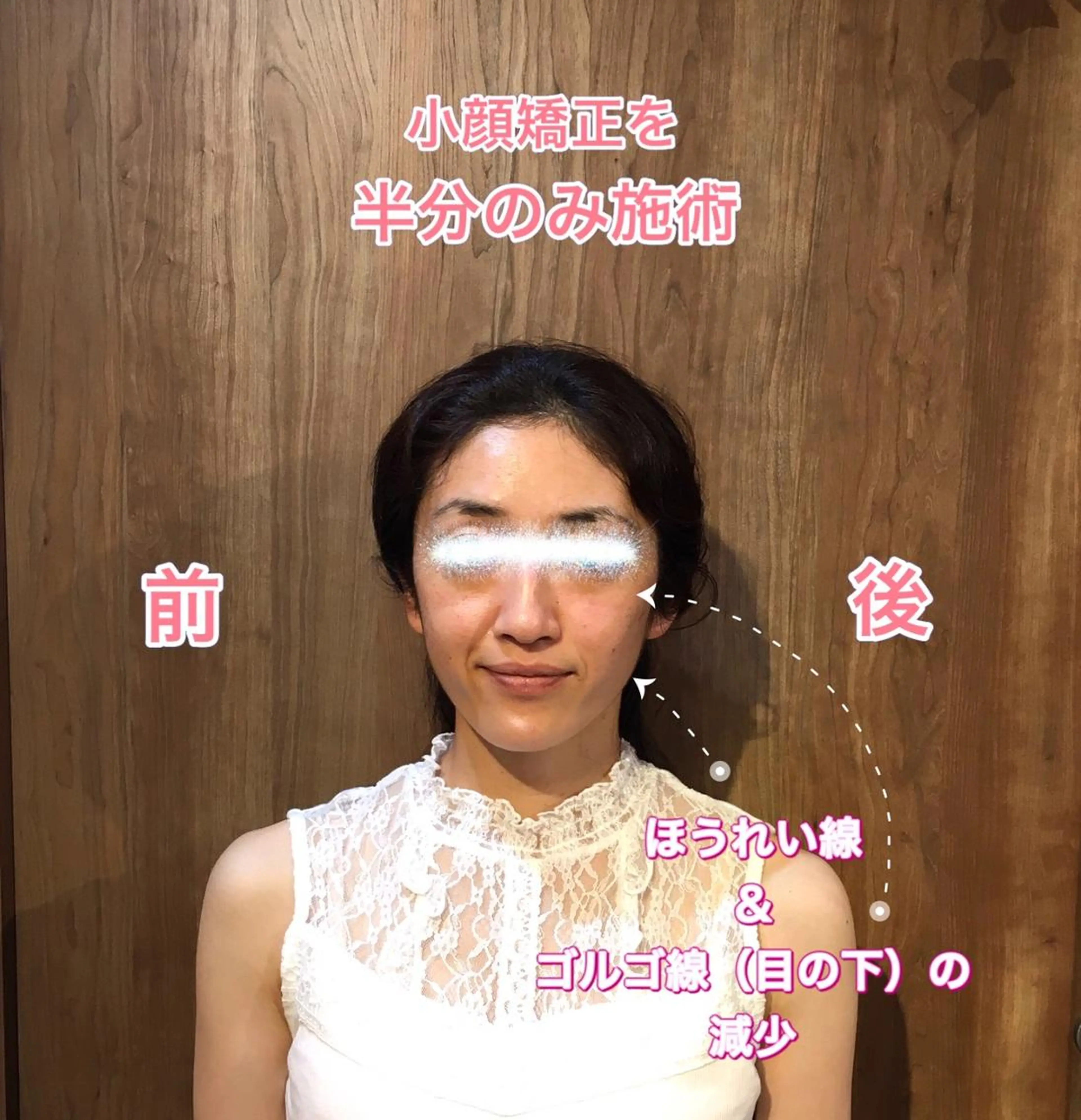 むくみ撃退、歪み改善!!小顔矯正の写真