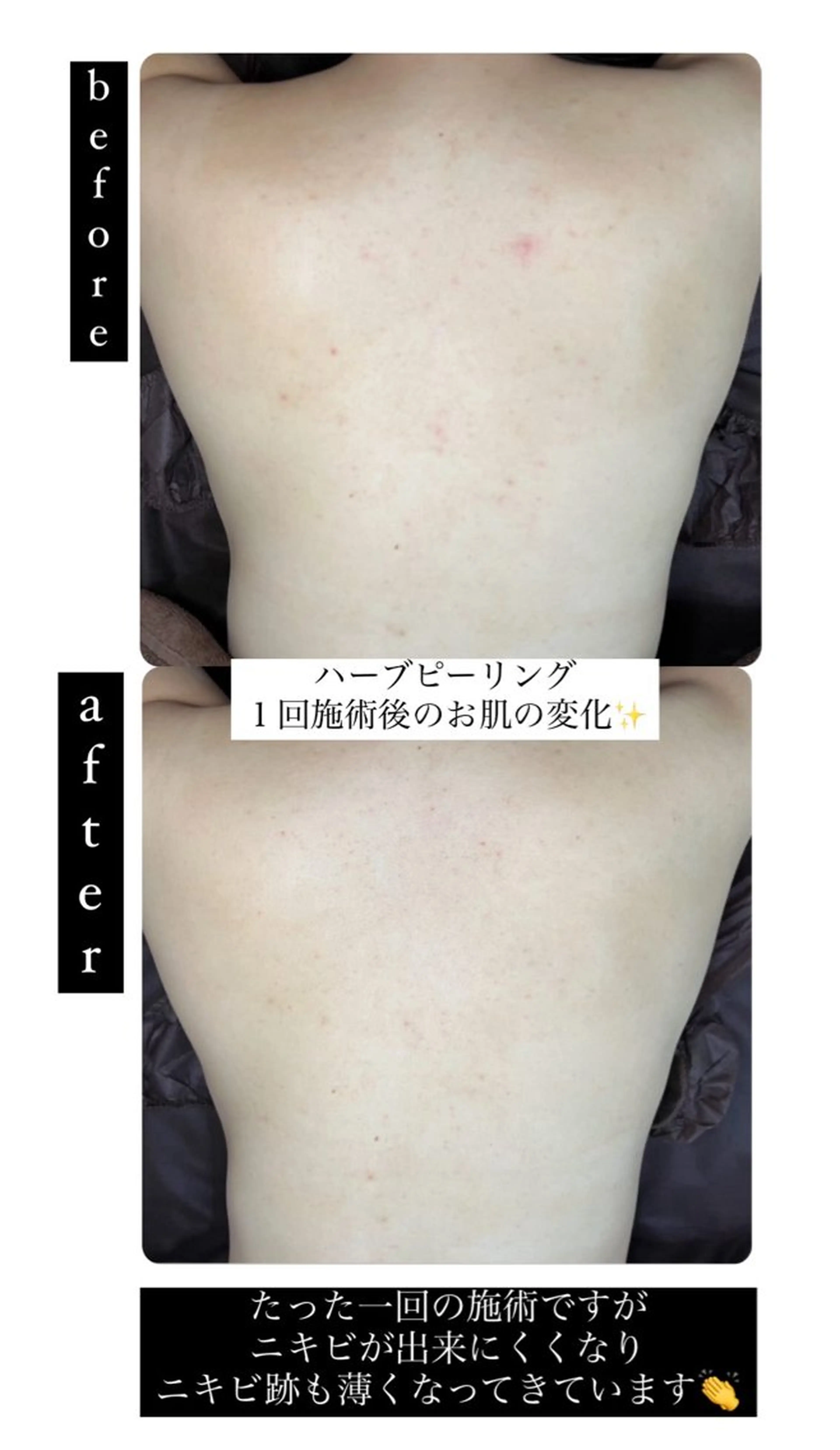 エステ ベラージュ【美背中・ 美尻・フェイシャル】のエステ・リラクイメージ