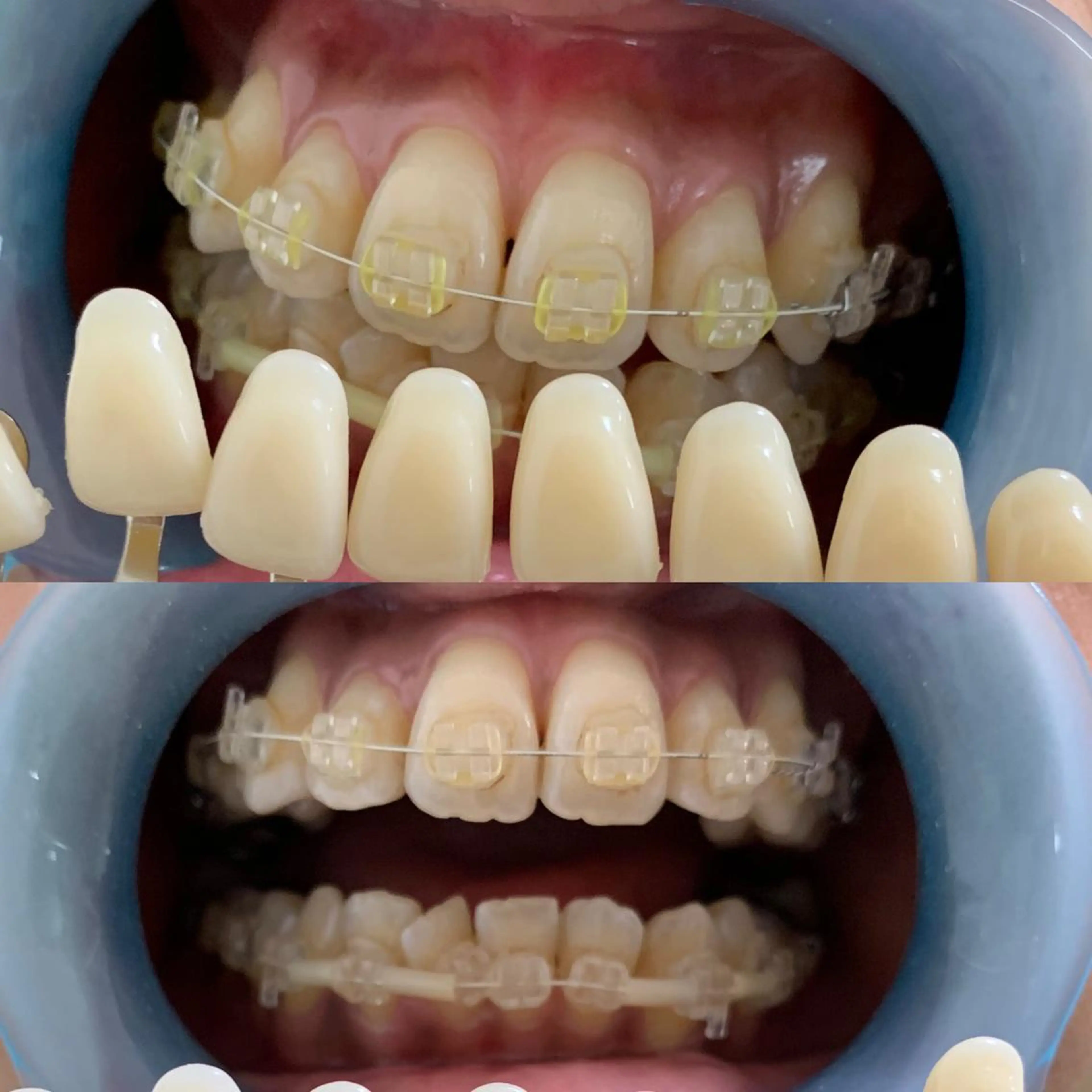 217whitening  room所属・217 ホワイトニングルームのエステ・リラクイメージ