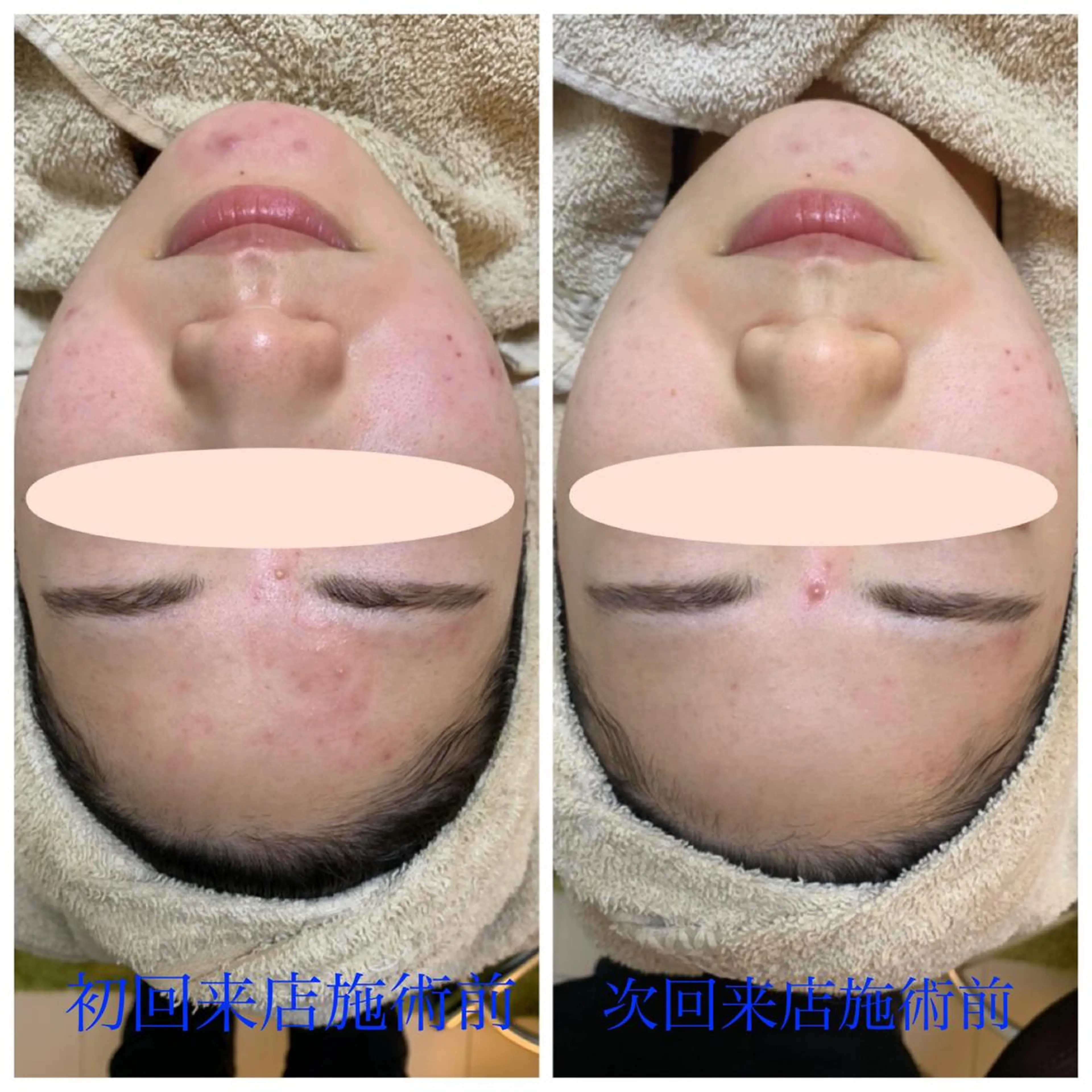 エステ リラク エステティック Nanagiのエステ・リラクイメージ