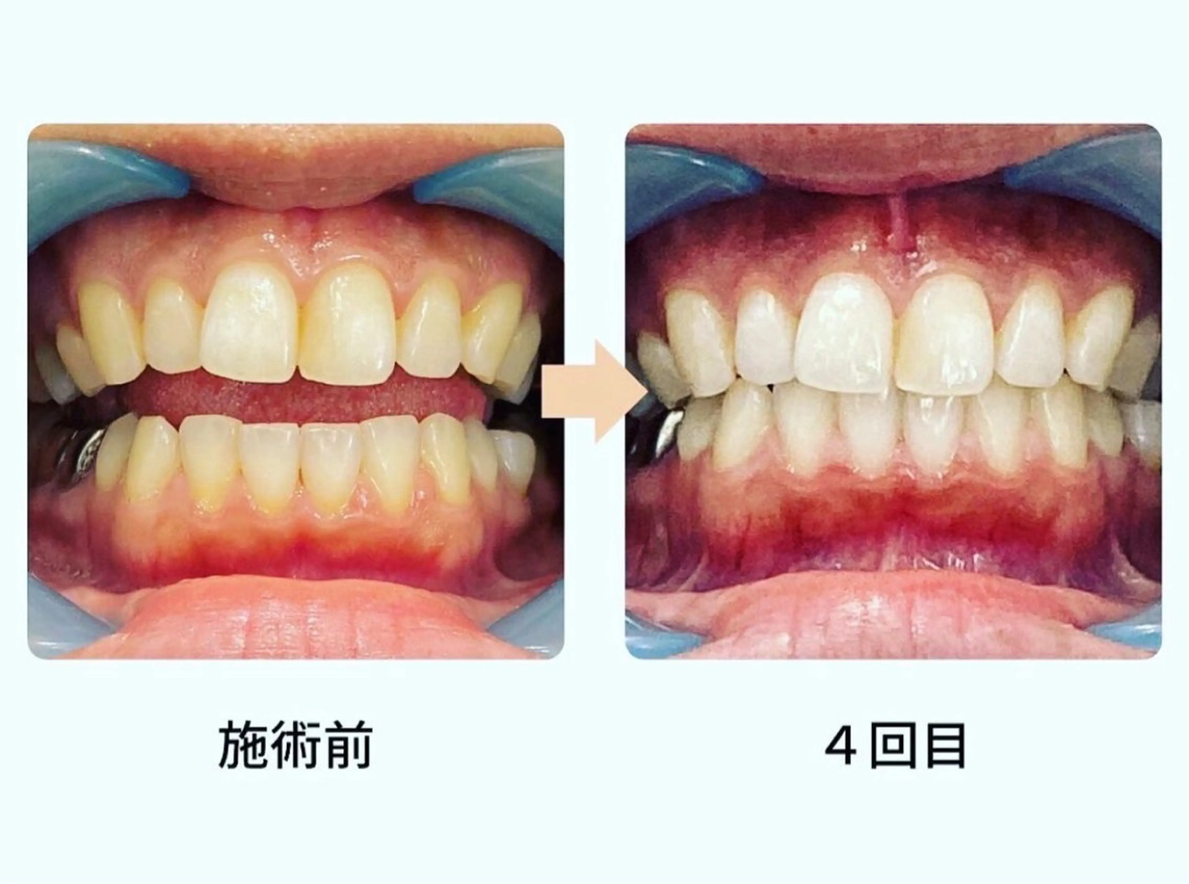 その他 メンズ脱毛サロンReyz（レイズ）所属・メンズ脱毛サロン Reyz（レイズ）のエステ・リラクイメージ