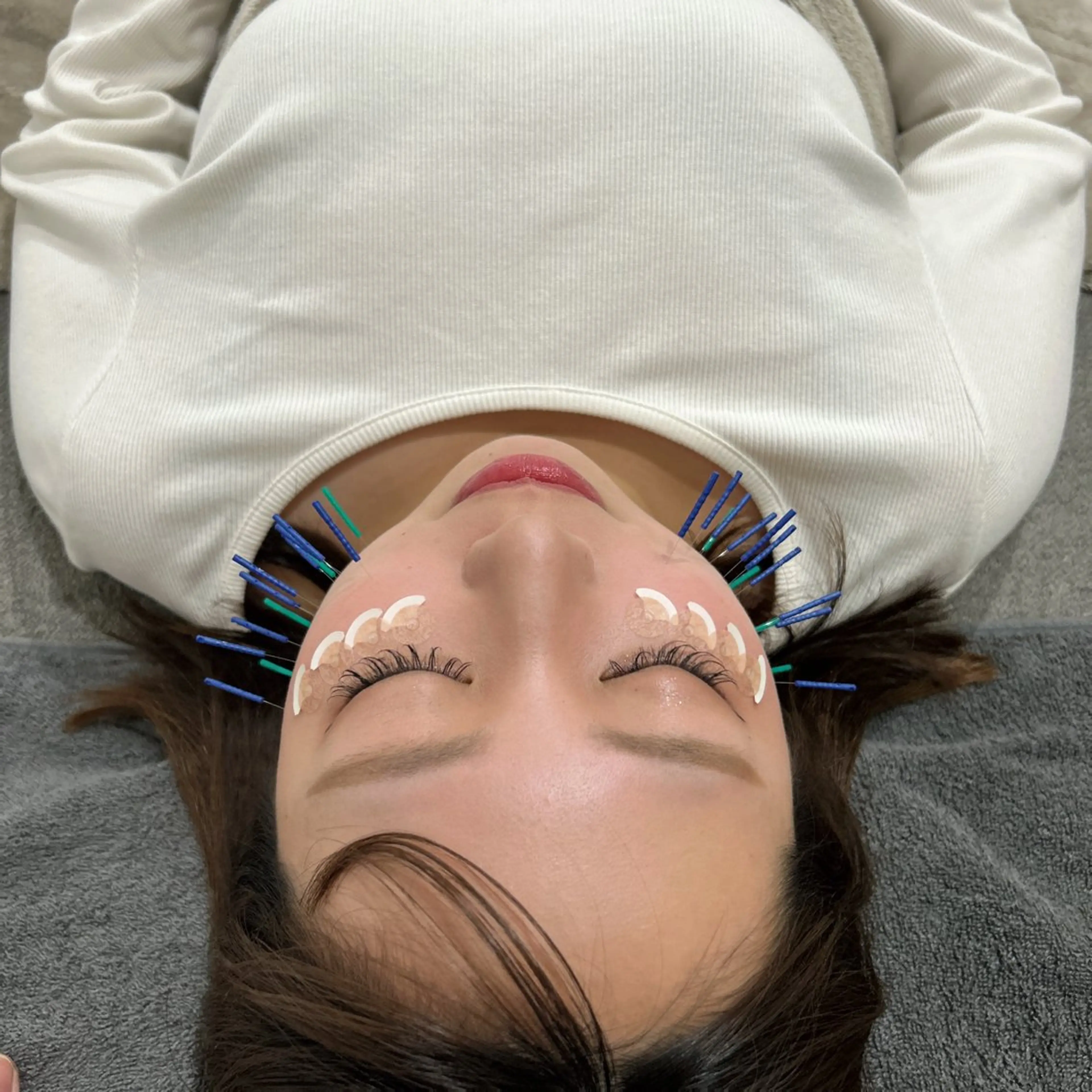 エステ リラク 了鍼灸整骨院 Moriのエステ・リラクイメージ