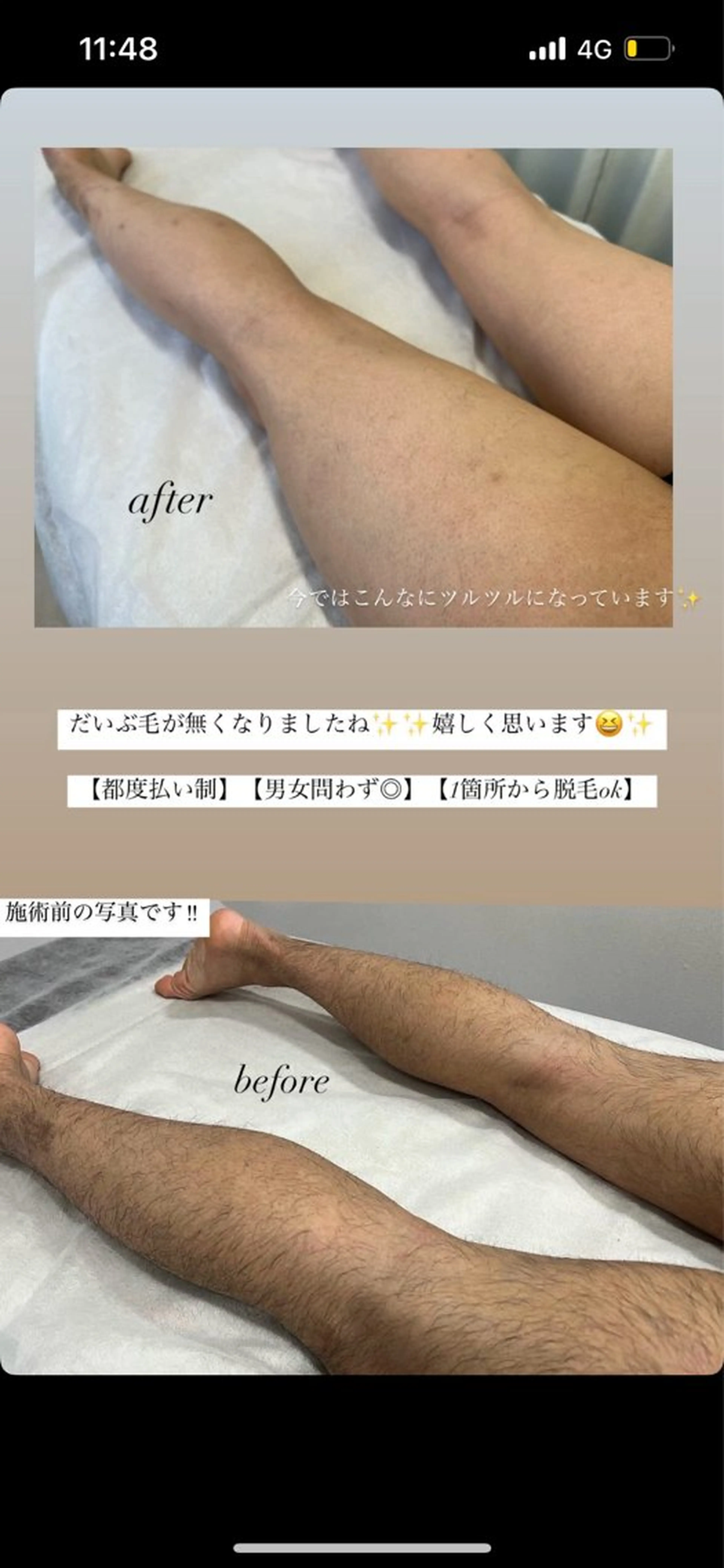 脱毛 瀬戸 梨子のエステ・リラクイメージ